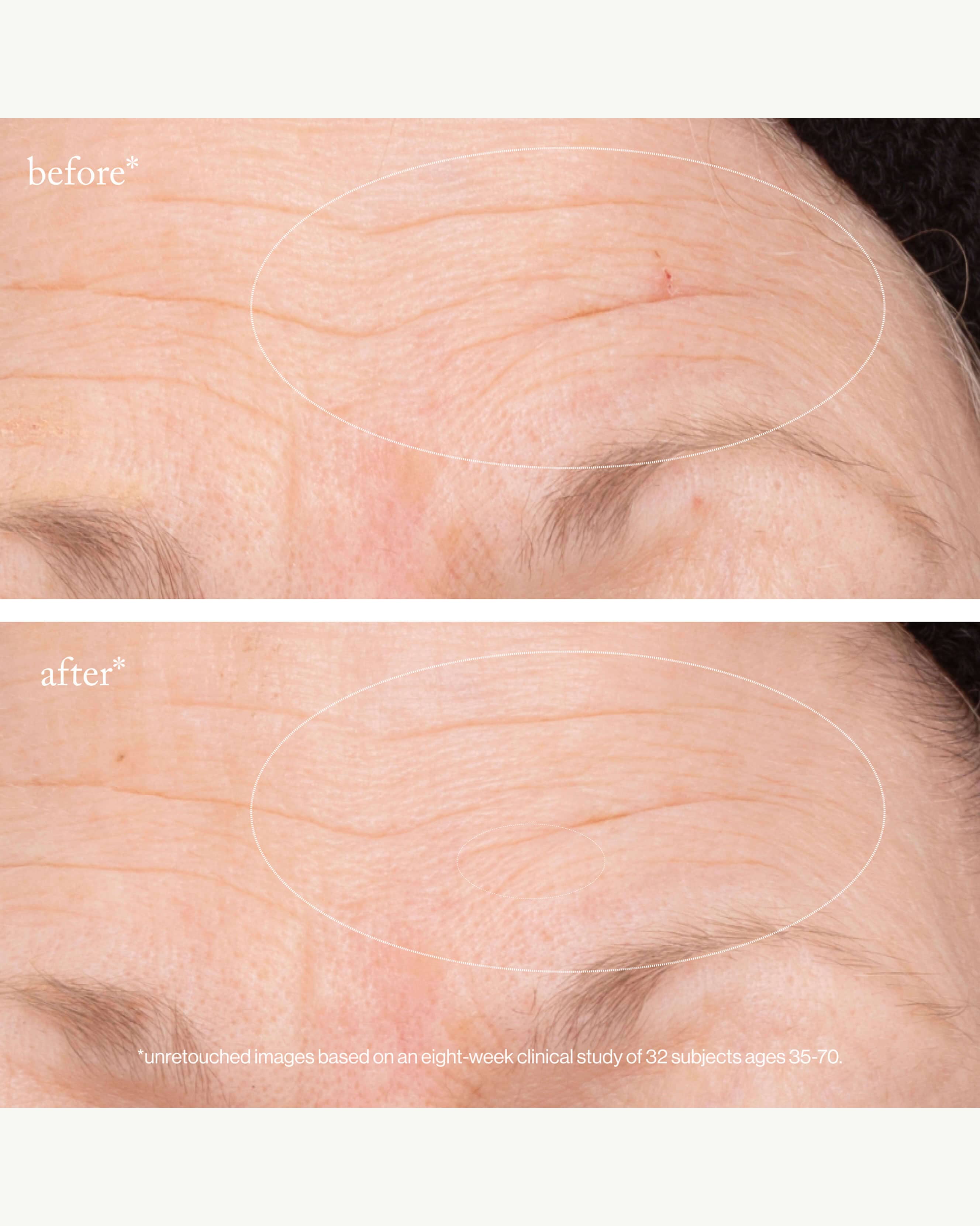 3x RETINOL REGENERATIVE SERUM - Image 3