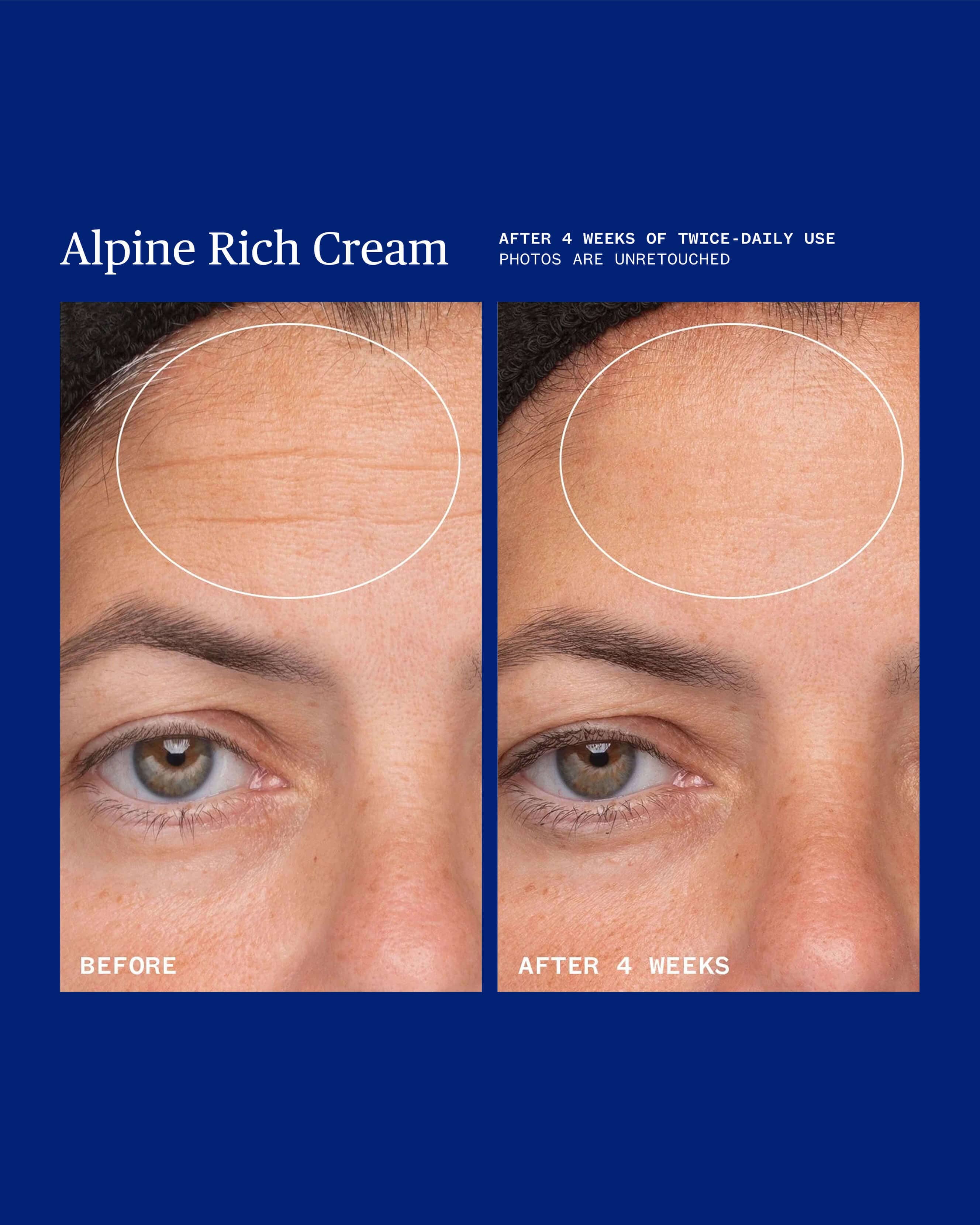 Alpine Rich Cream Barrier Moisturizer for Dry & Sensitive Skin - Image 3
