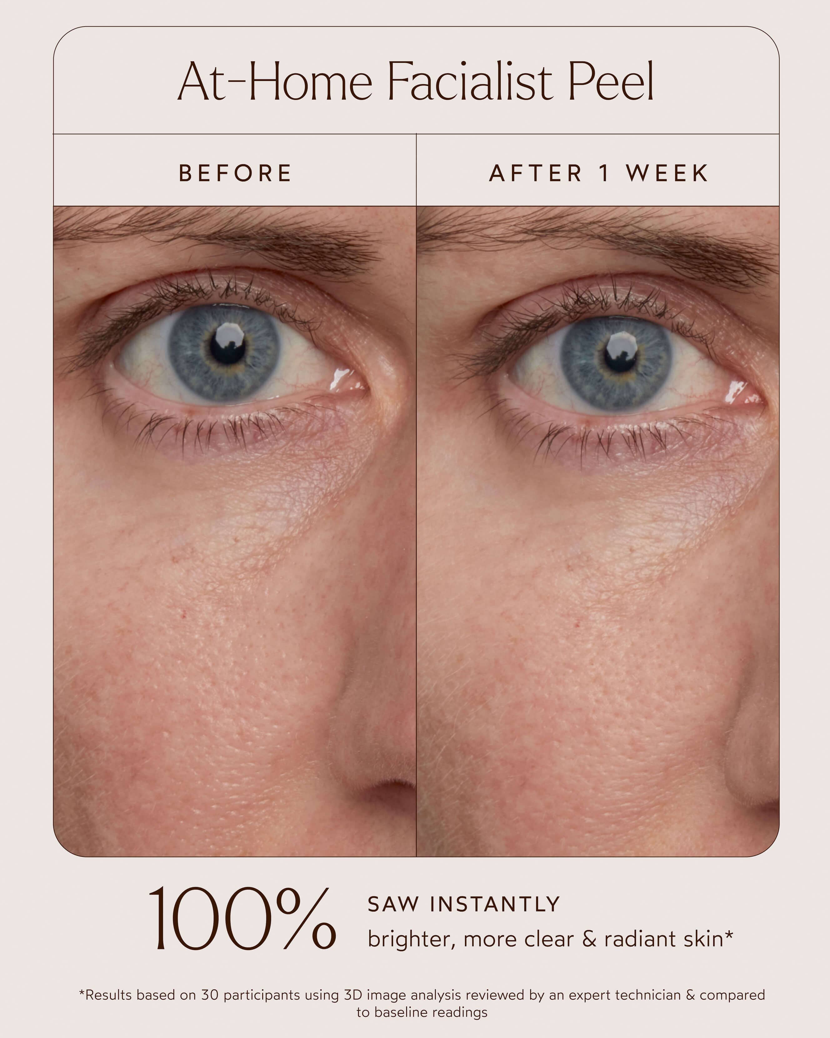 At-Home Facialist Peel - Image 3
