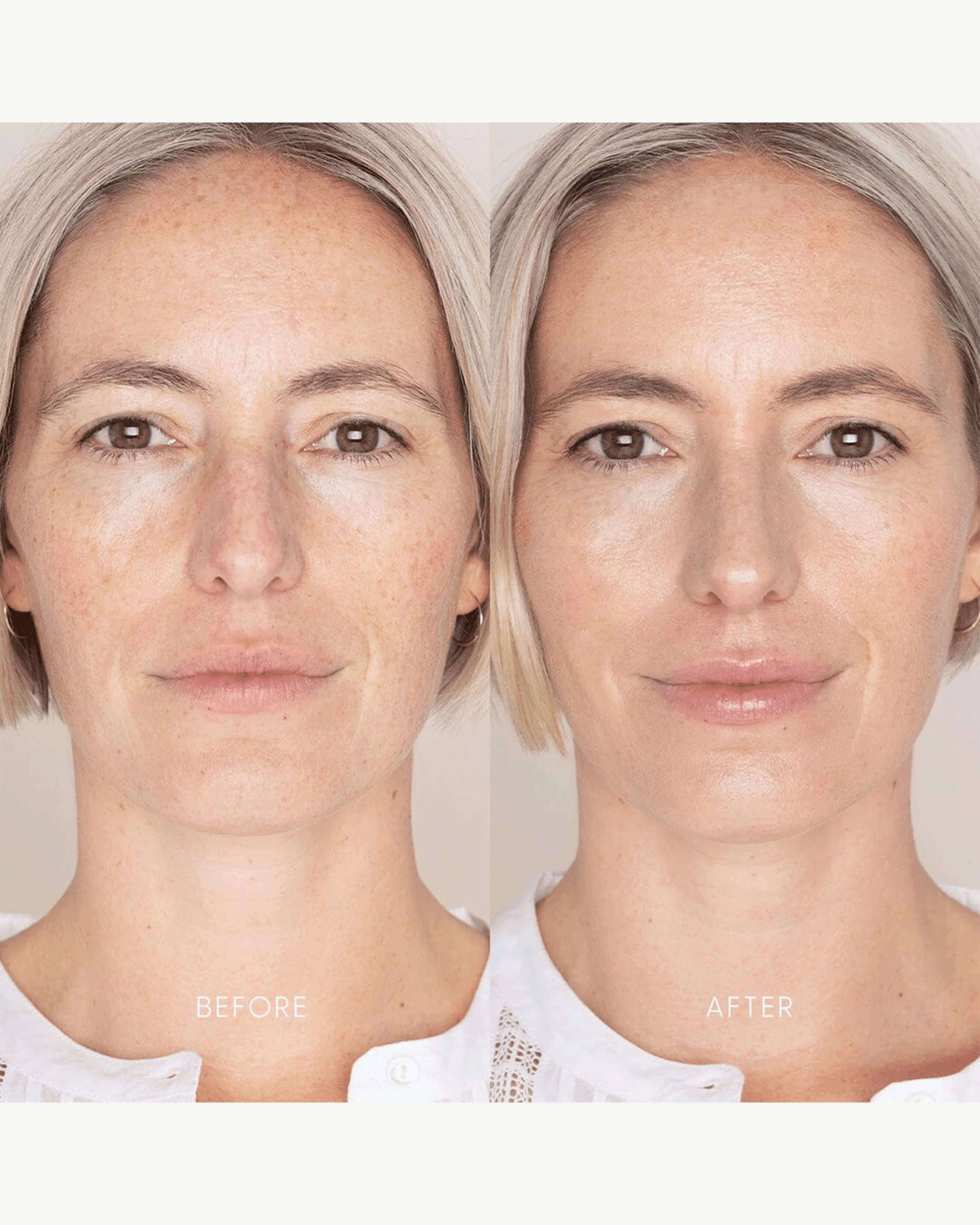 Best Skin Days SPF 30 - Image 26