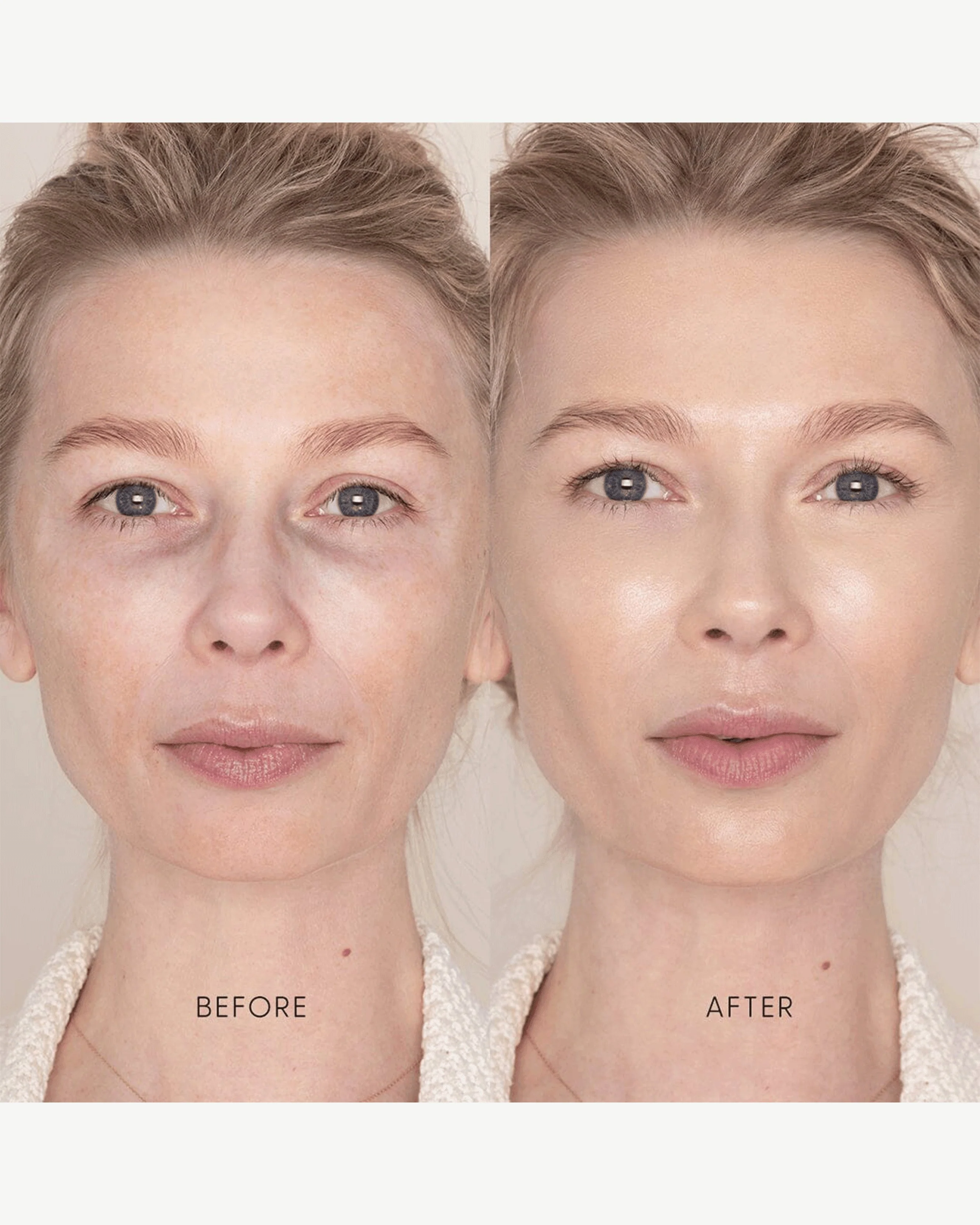 Best Skin Days Treatment Concealer - Image 15