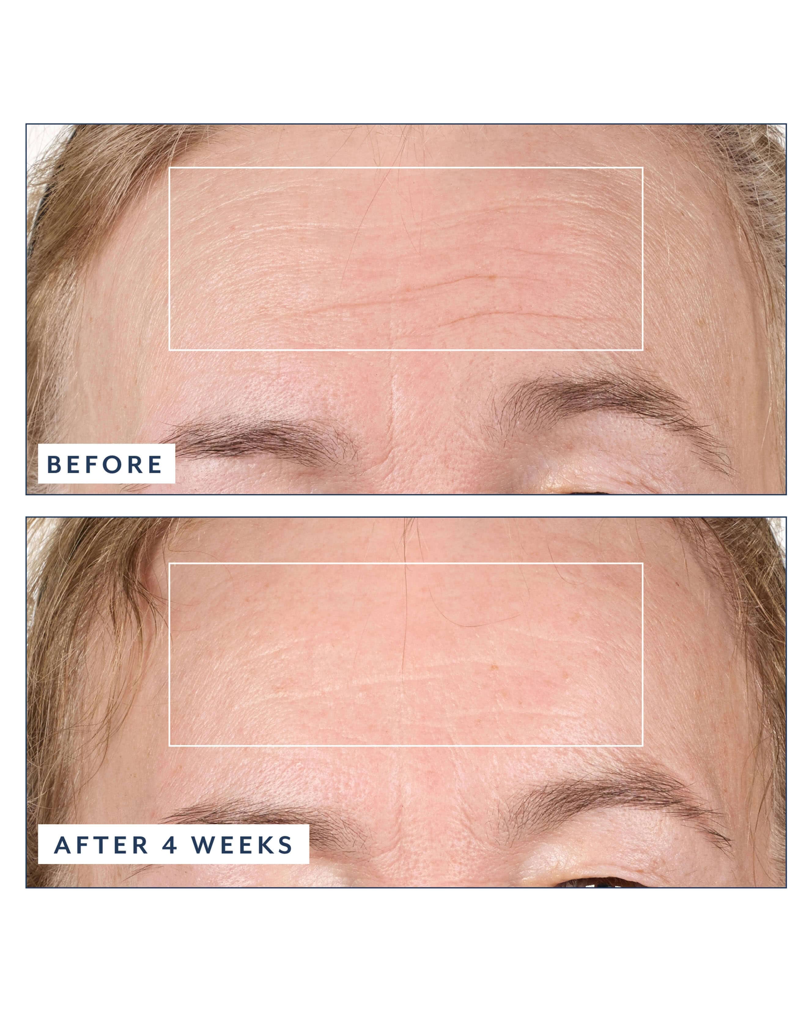 Black Tulip Regenerative Serum - Image 4