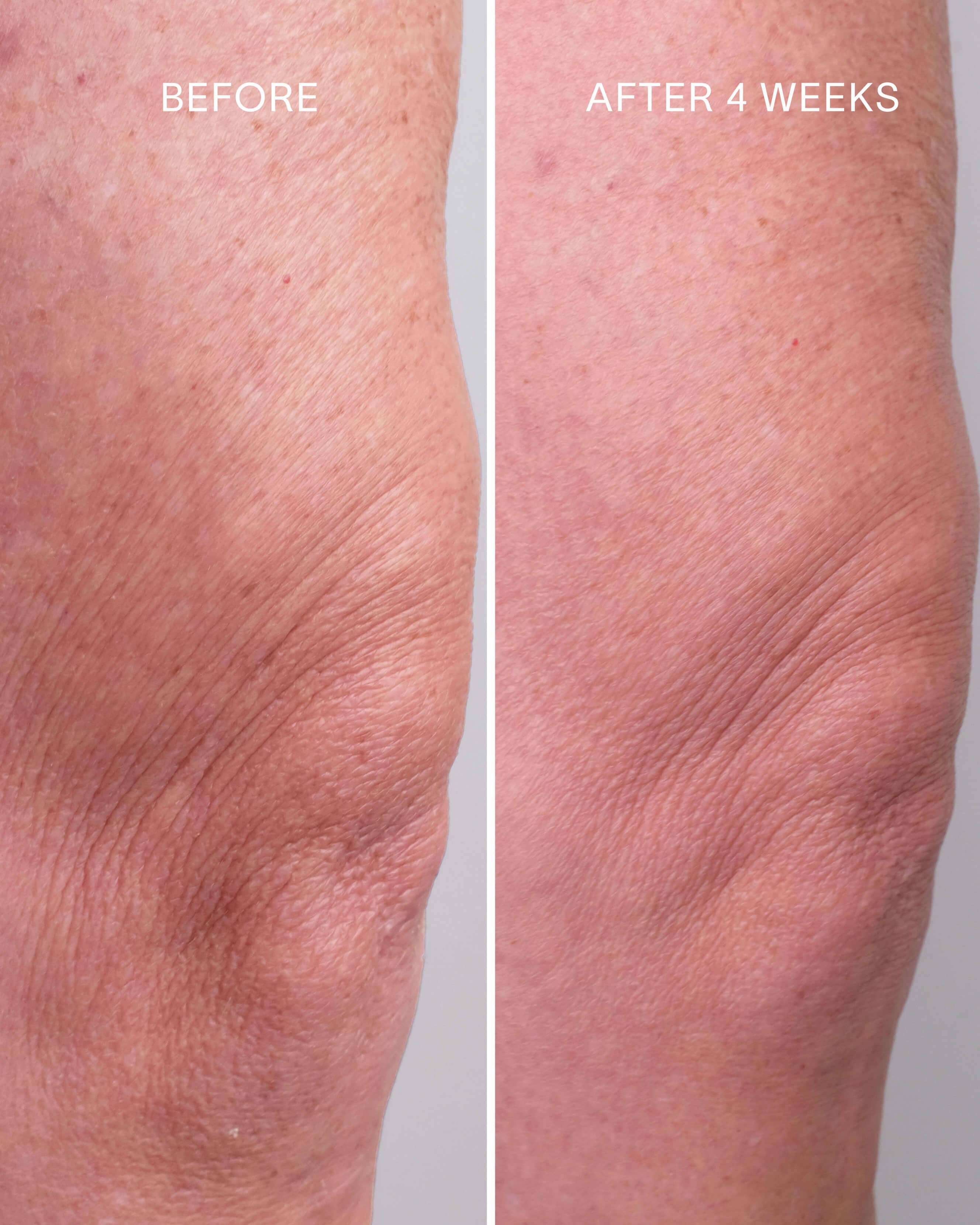 Glycolic + Bakuchiol Smoothing Body Treatment - Image 3