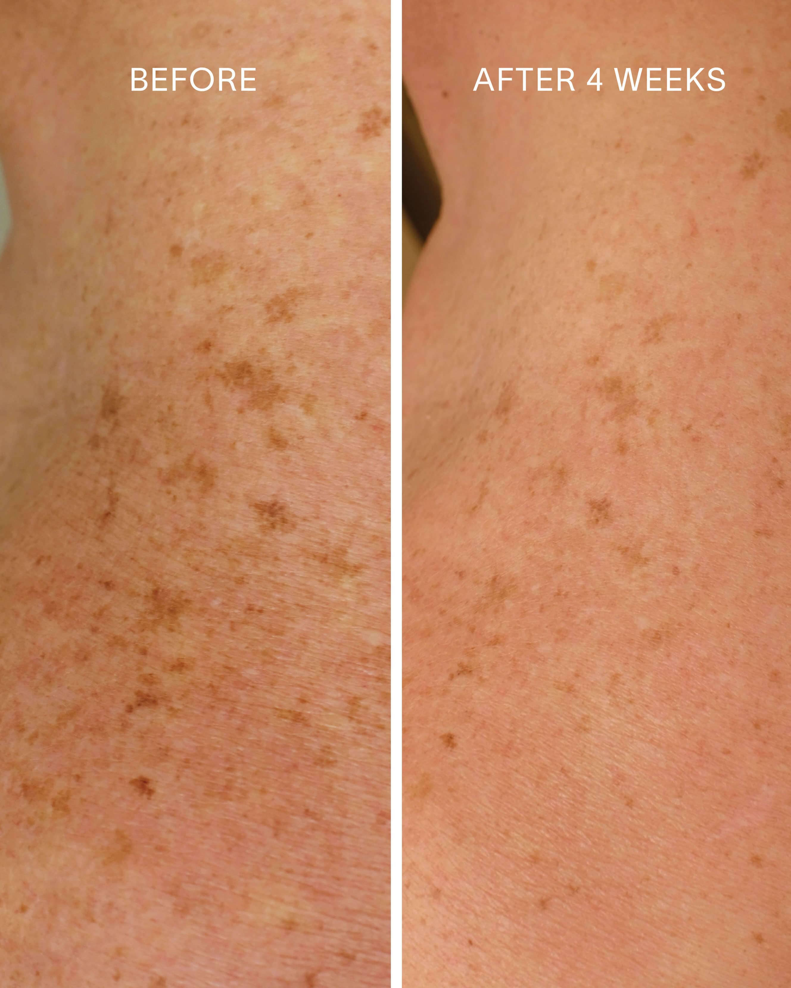 Glycolic + Bakuchiol Smoothing Body Treatment - Image 4