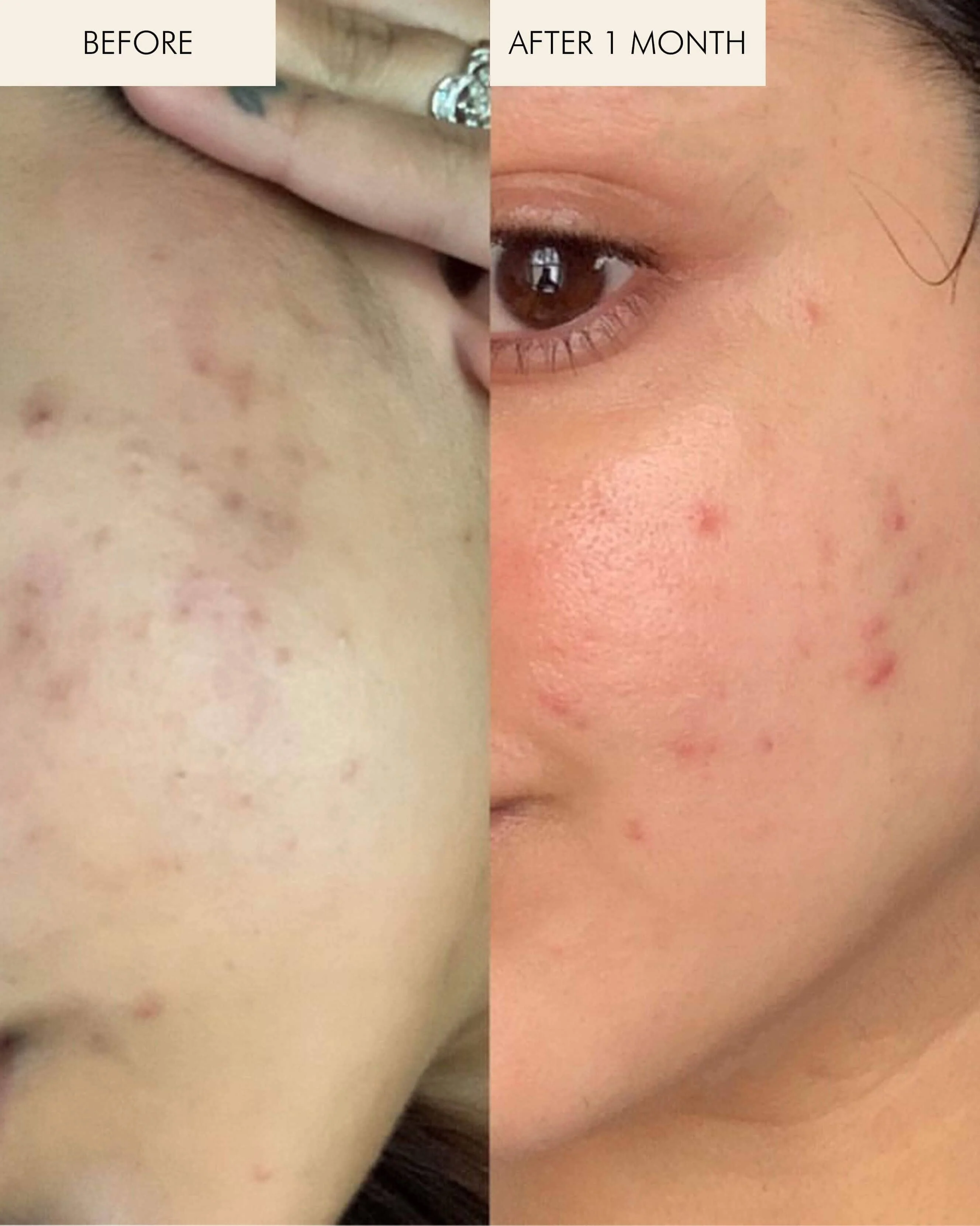 Sea Vitamin C Serum for Brightening Dark Spots & Redness with Algae - Image 3