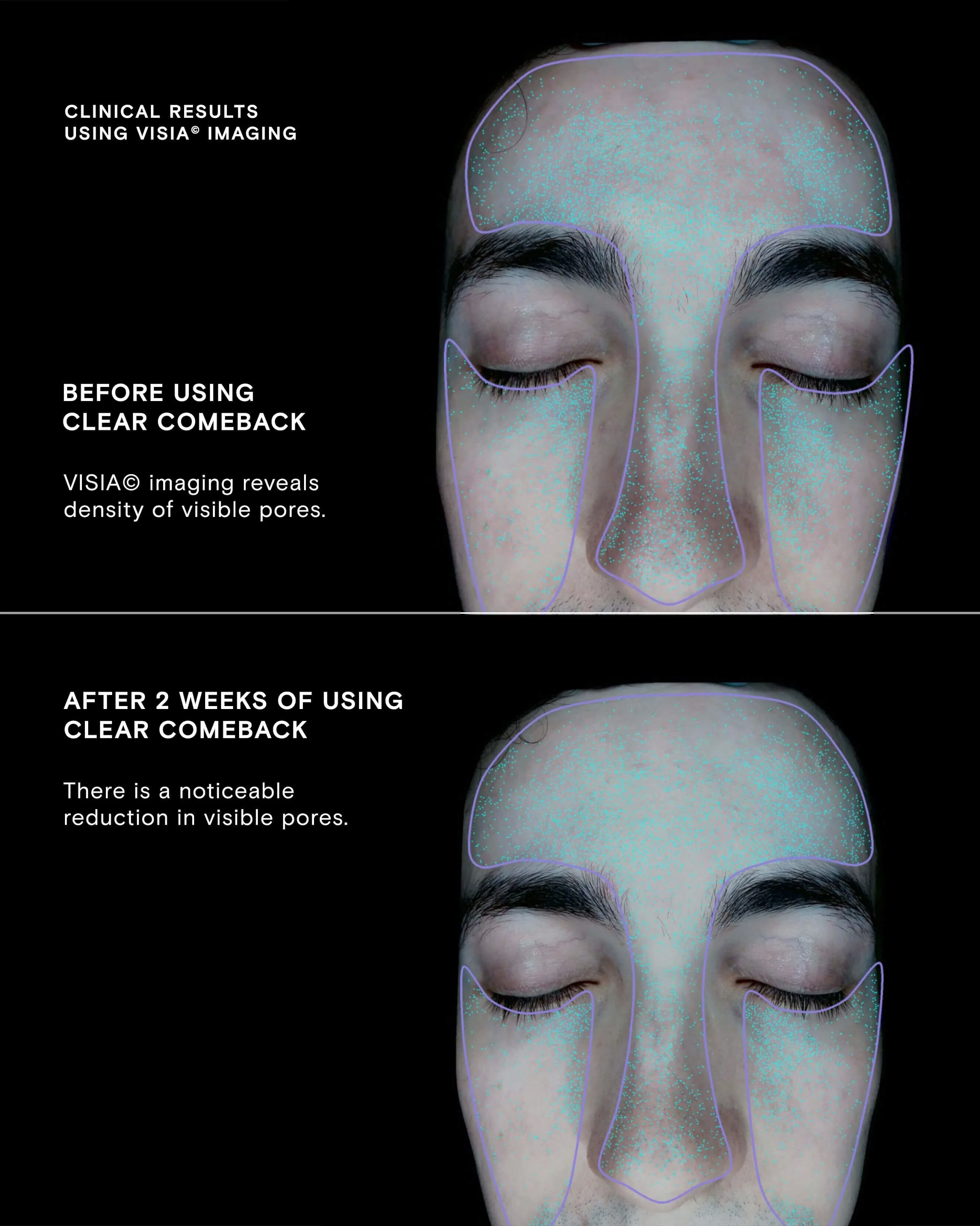 Clear Comeback Probiotic Enzyme Power Serum - Image 4