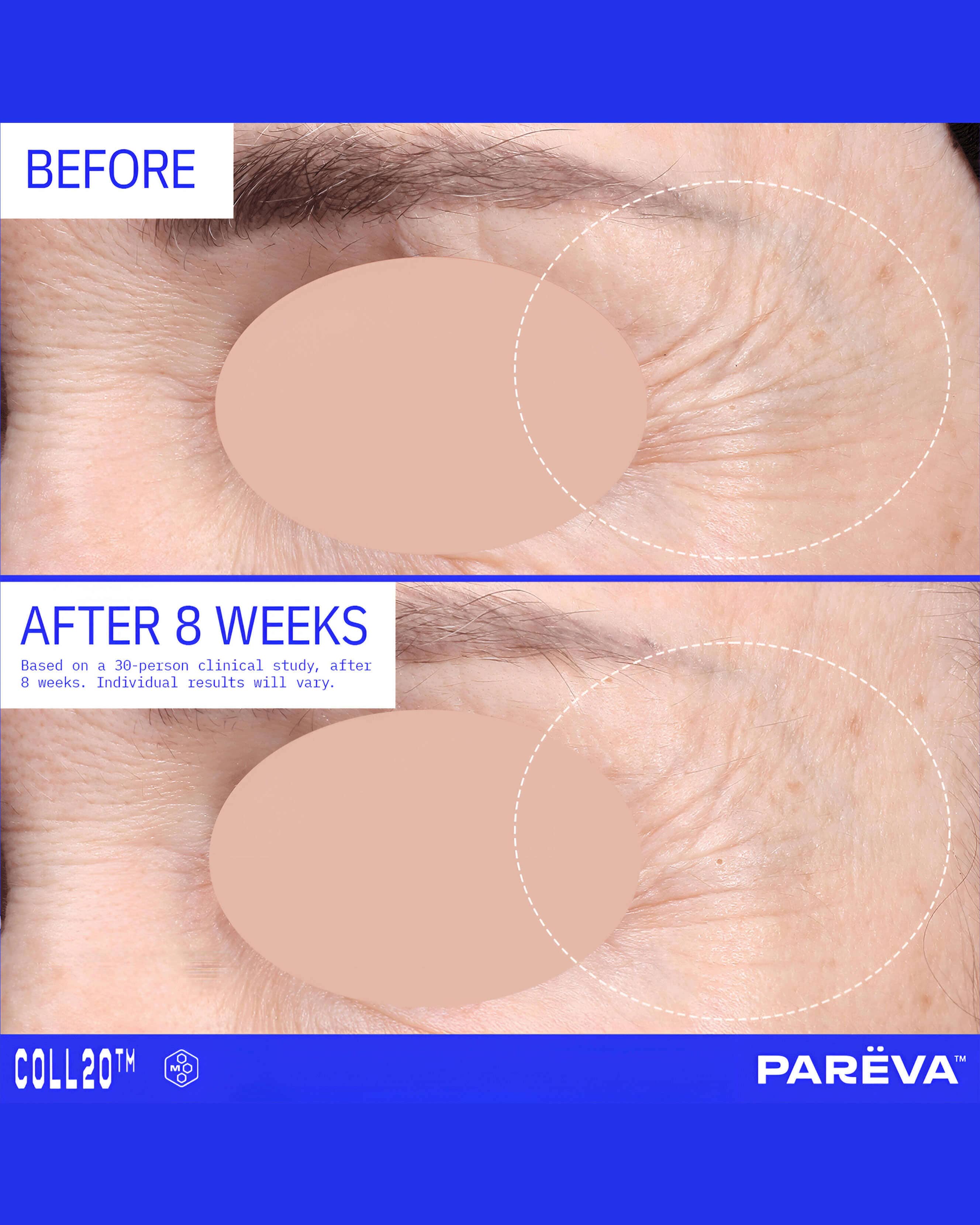 Coll20 Gel Cream Moisturizer - Image 4