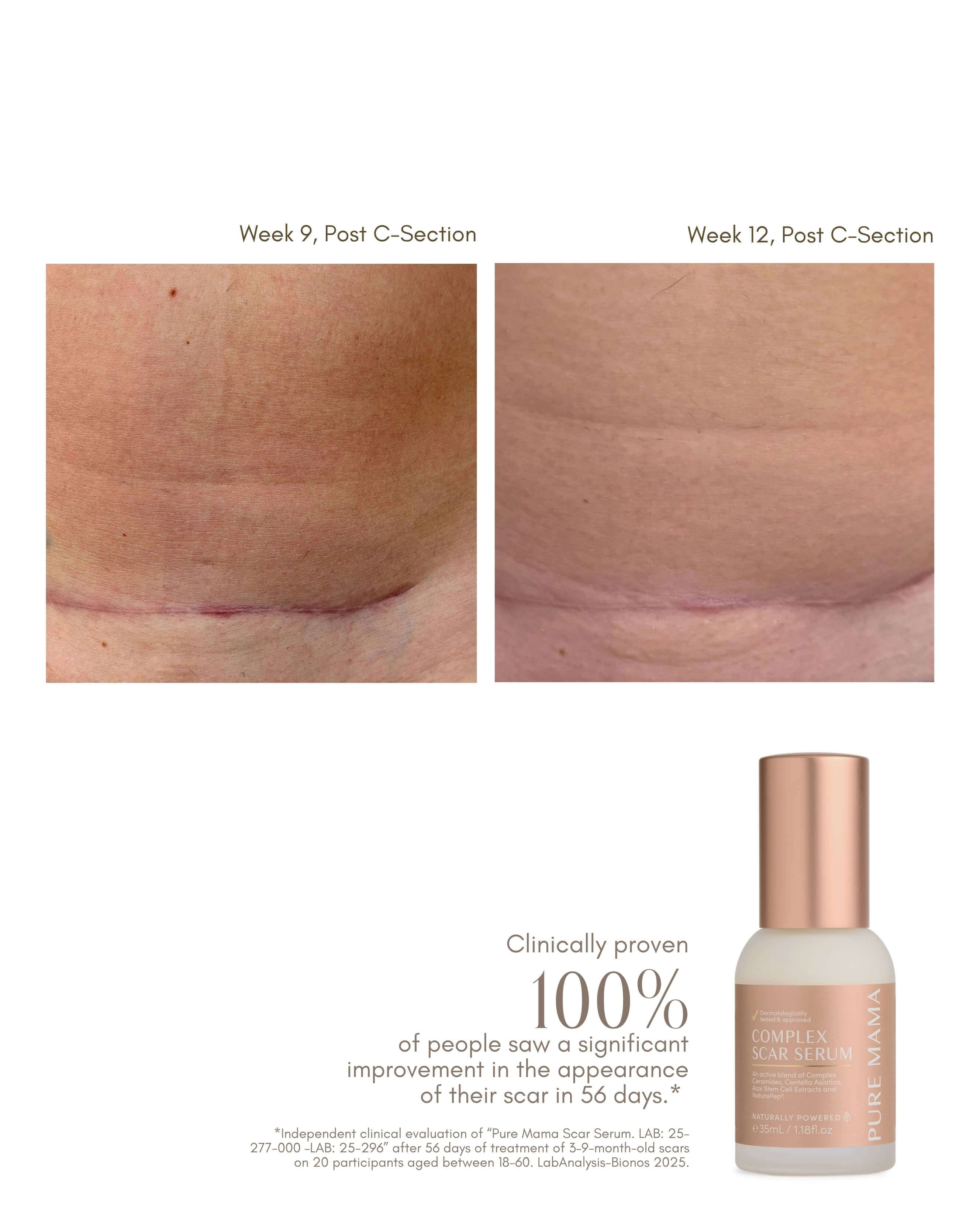 Complex Scar Serum - Image 3