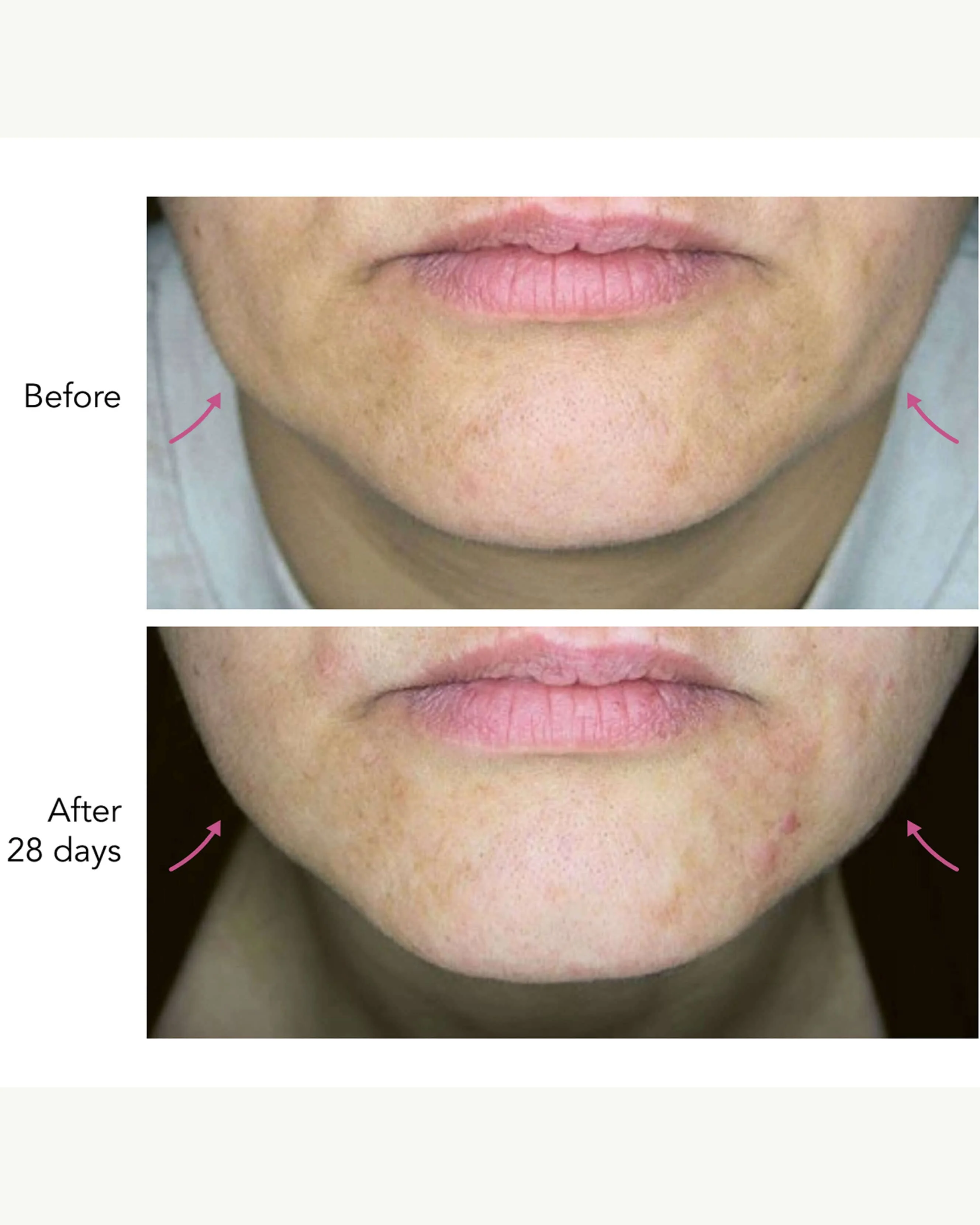 DNA-42 Clinicalift Serum - Image 3