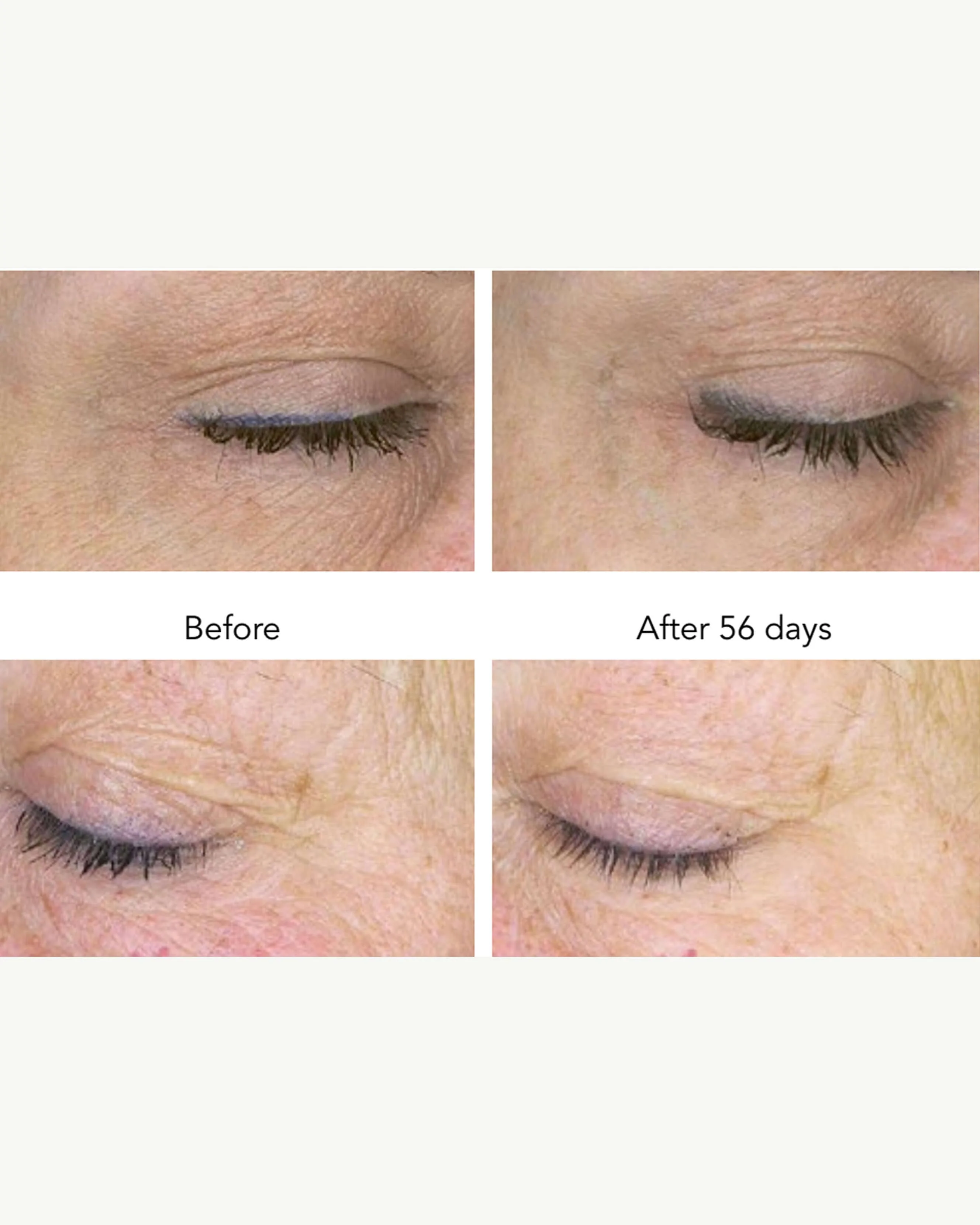 DNA-42 Clinicalift Serum - Image 4