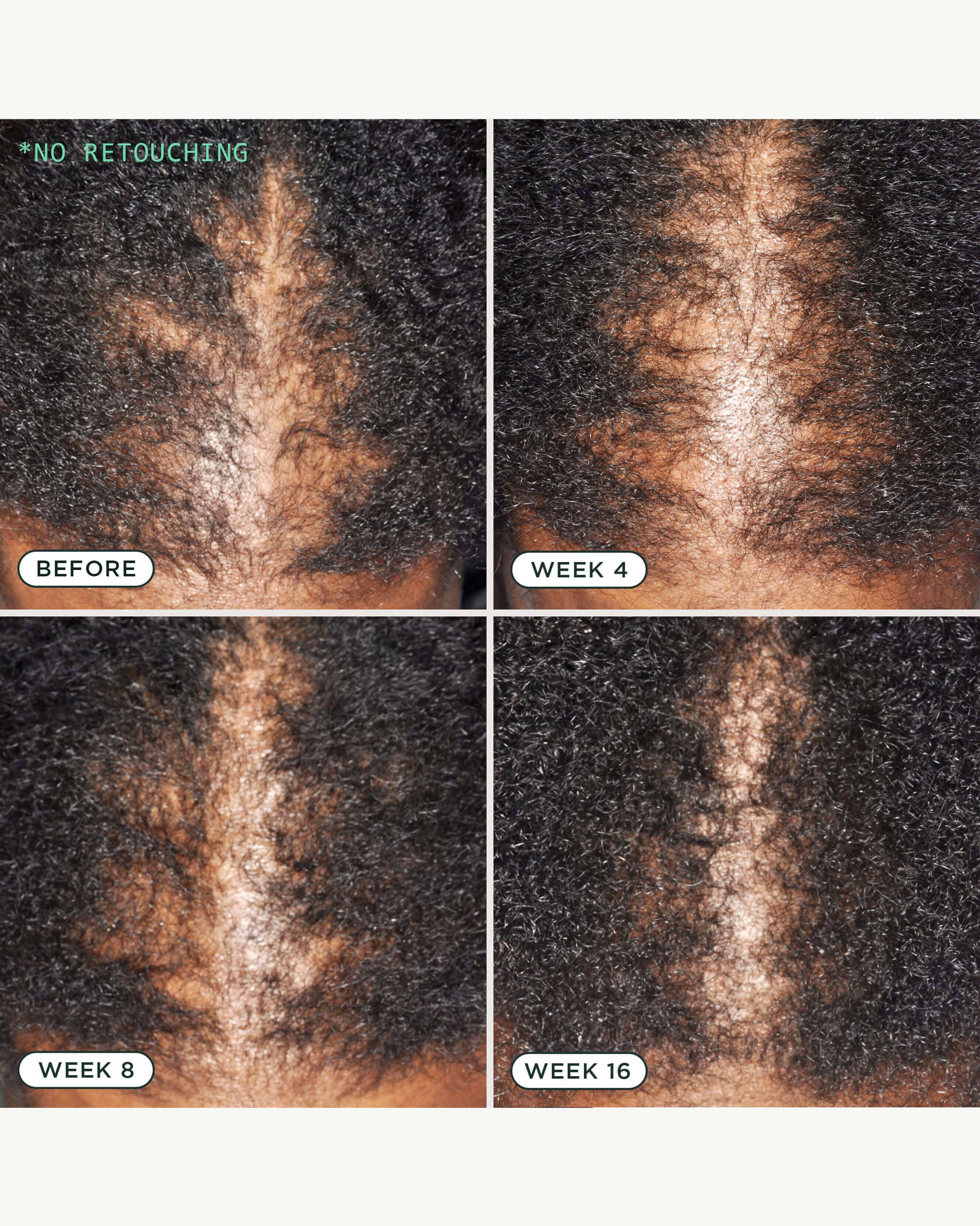 DNA Scalp Serum - Image 11