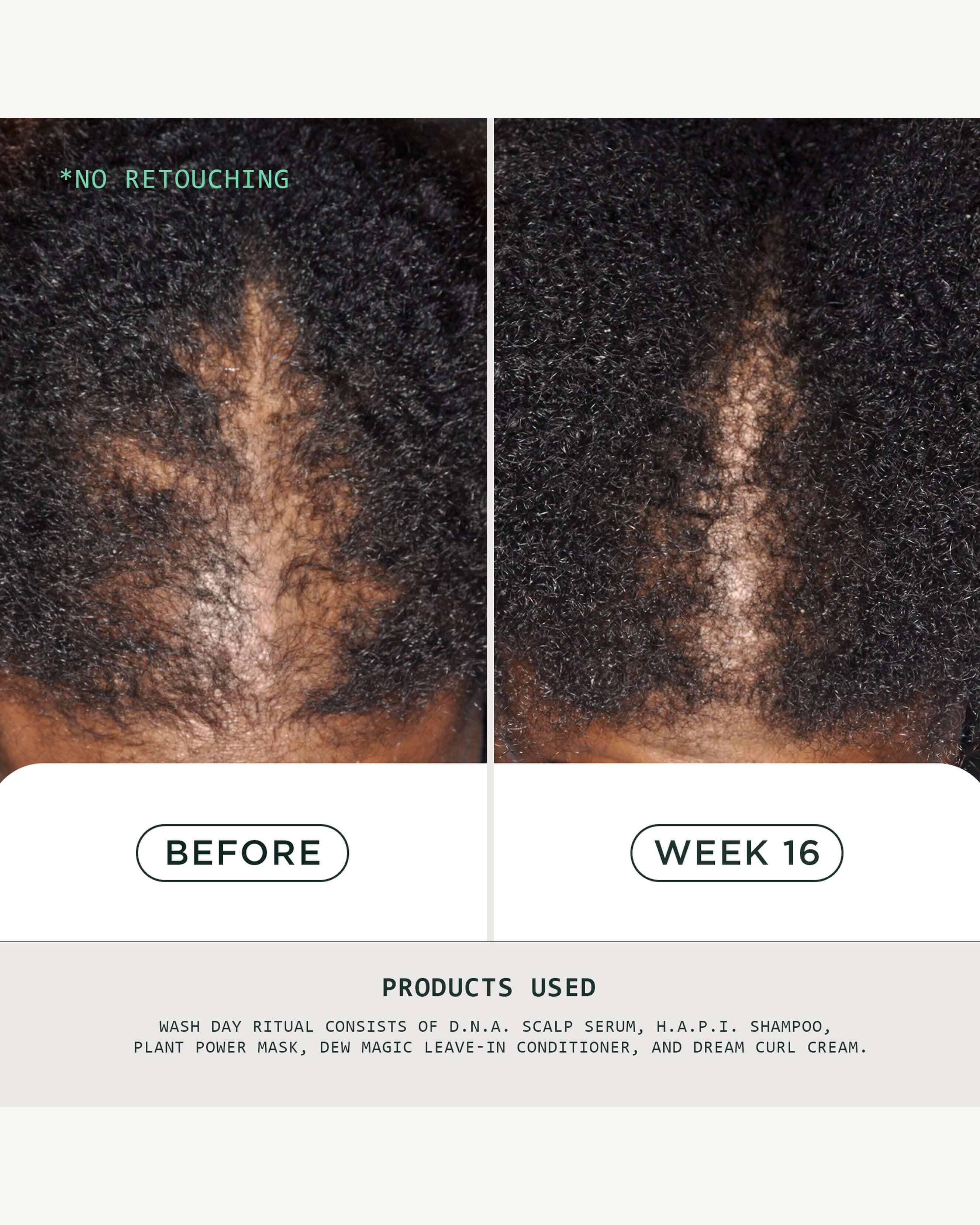 DNA Scalp Serum - Image 3