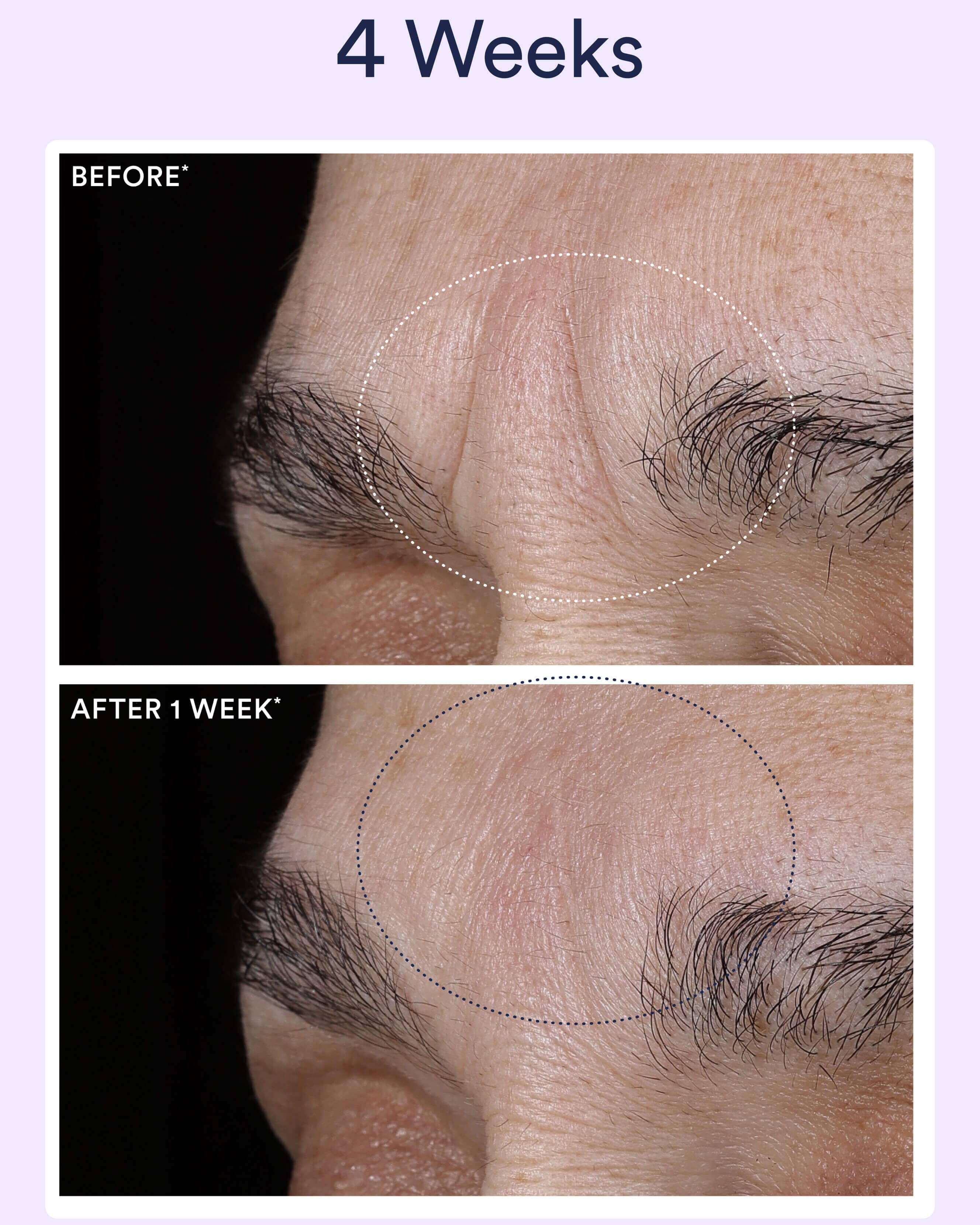 Dream Night Serum with Bio-Retinol - Image 3