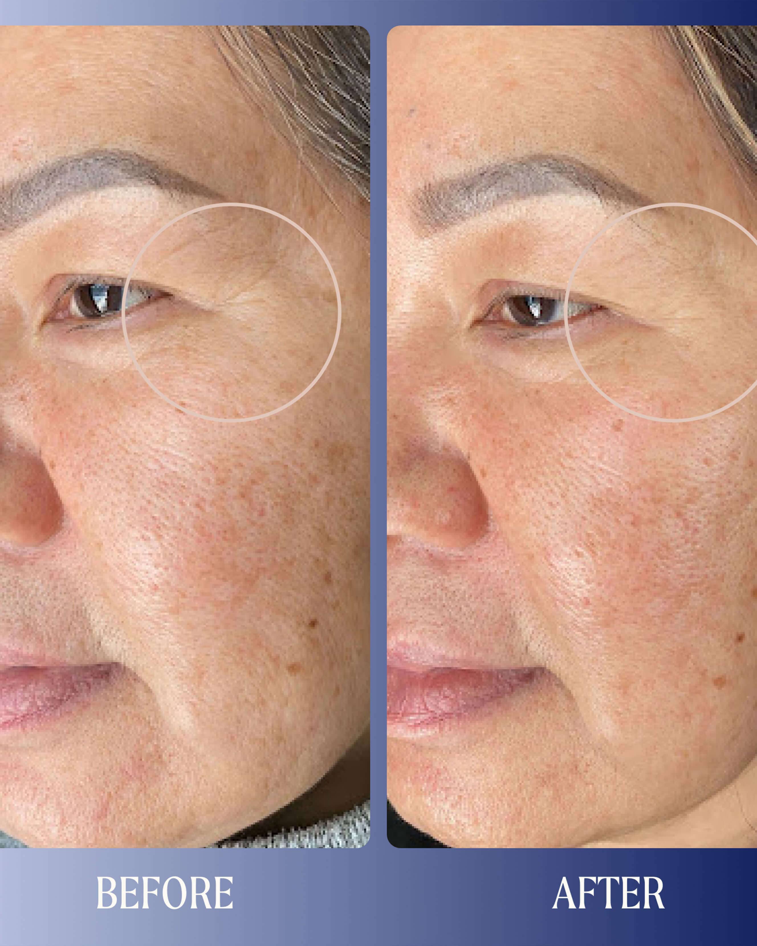 Dreamwave 2% Bio-Retinoid Complex Overnight Serum - Image 4