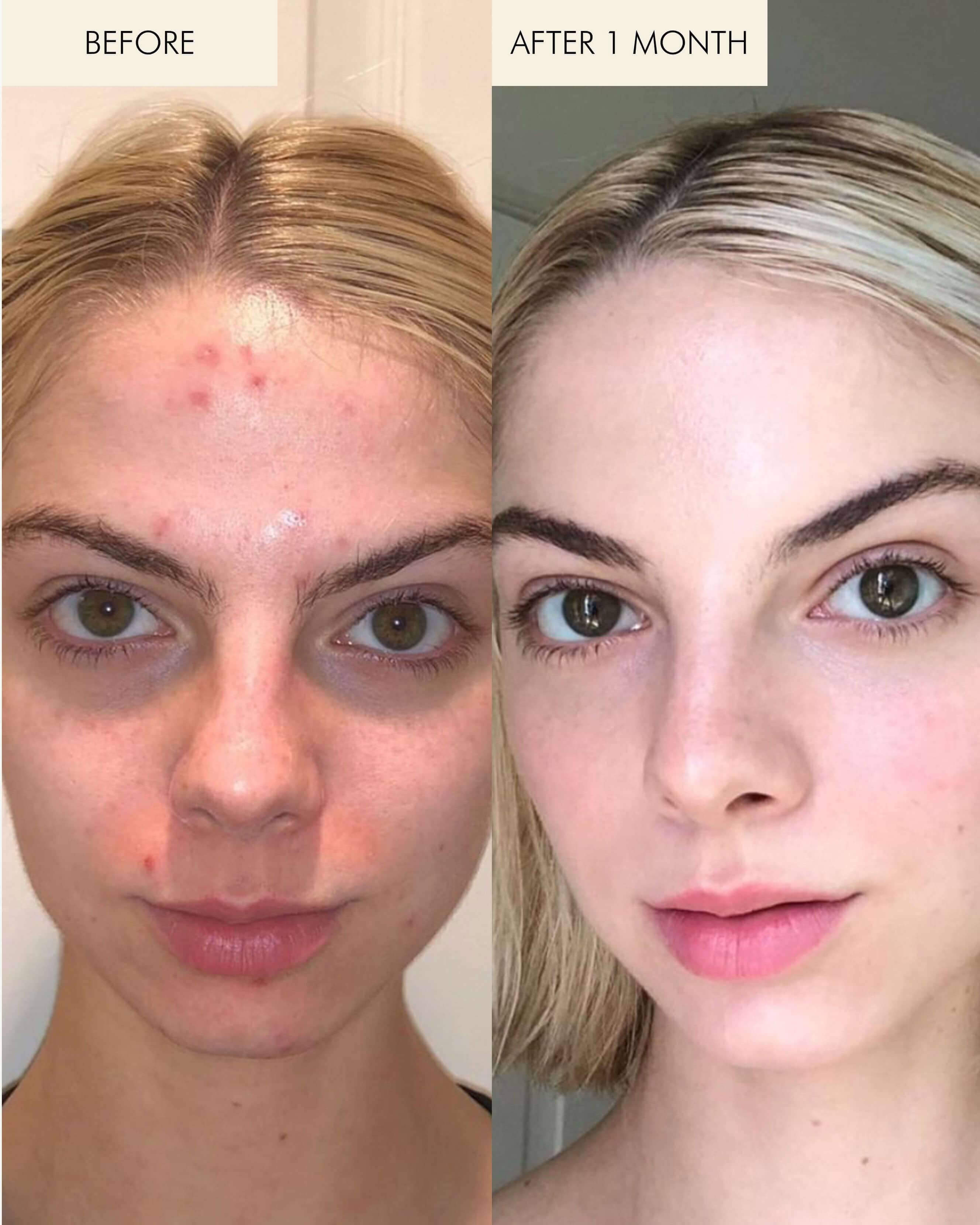 1.2% Clean Algae Retinol Face Oil for Anti-Aging and Wrinkles with Green Tea - Image 5