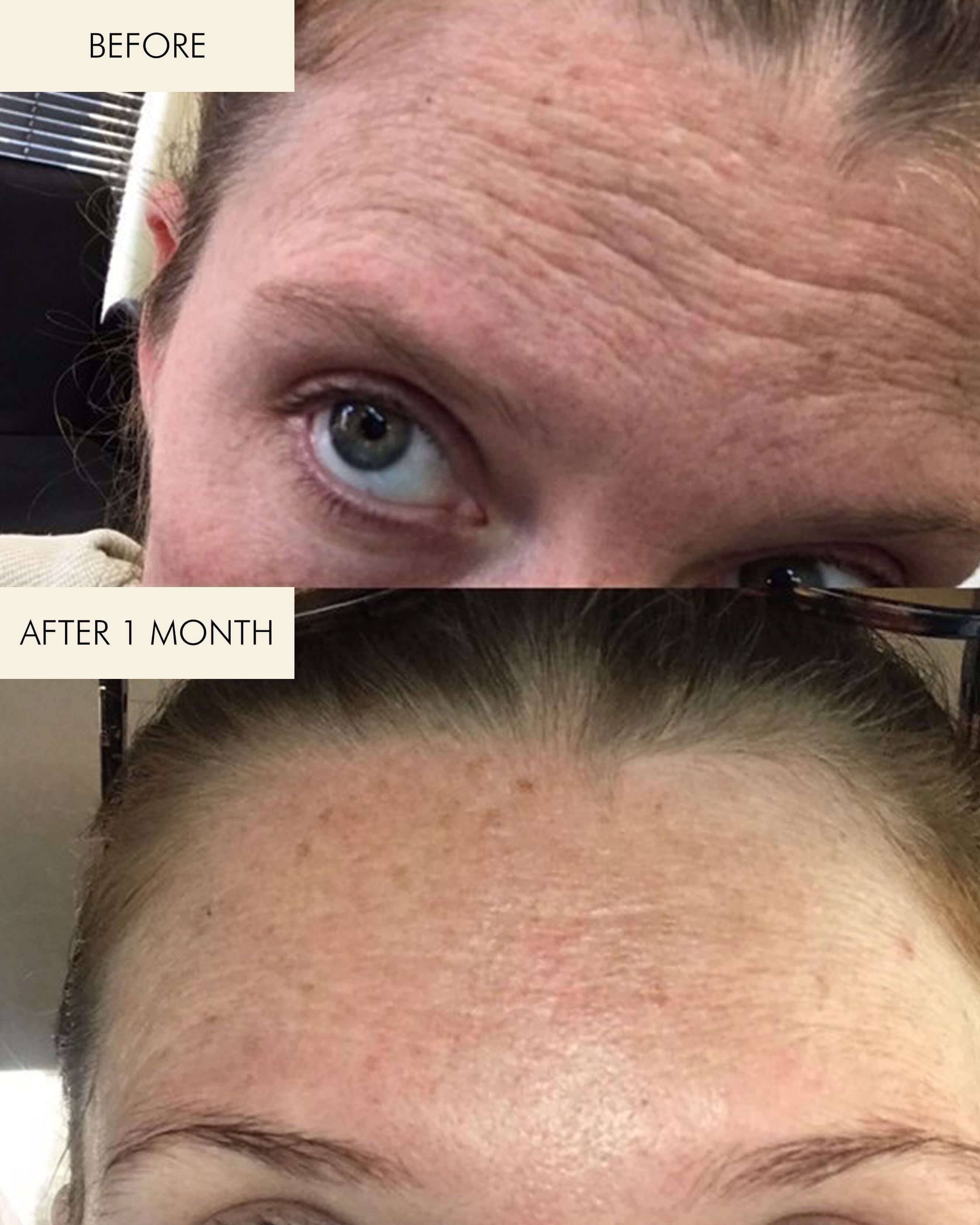 1.2% Clean Algae Retinol Face Oil for Anti-Aging and Wrinkles with Green Tea - Image 6