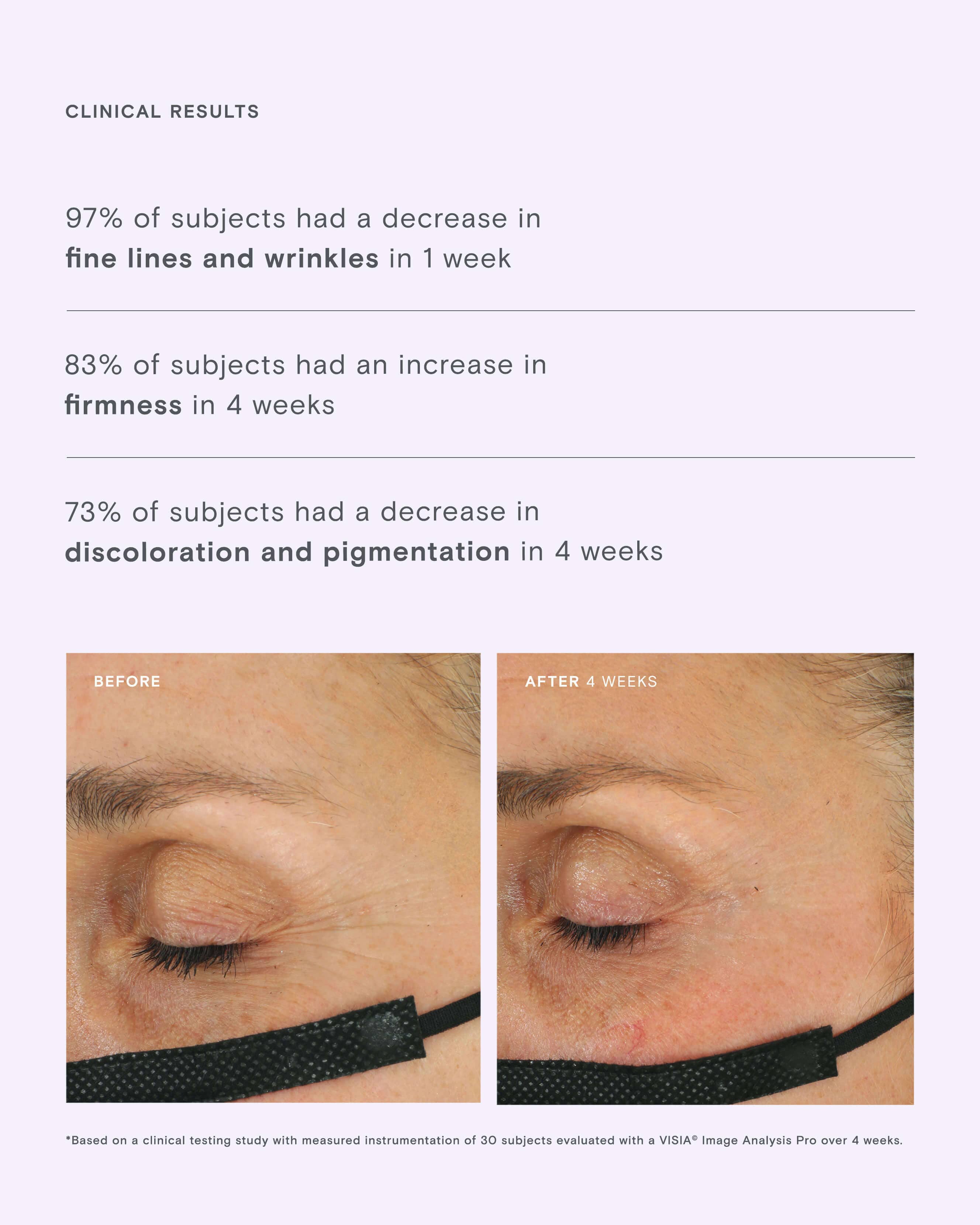 Firming Filter CoQ10 Antioxidant Power Serum - Image 4