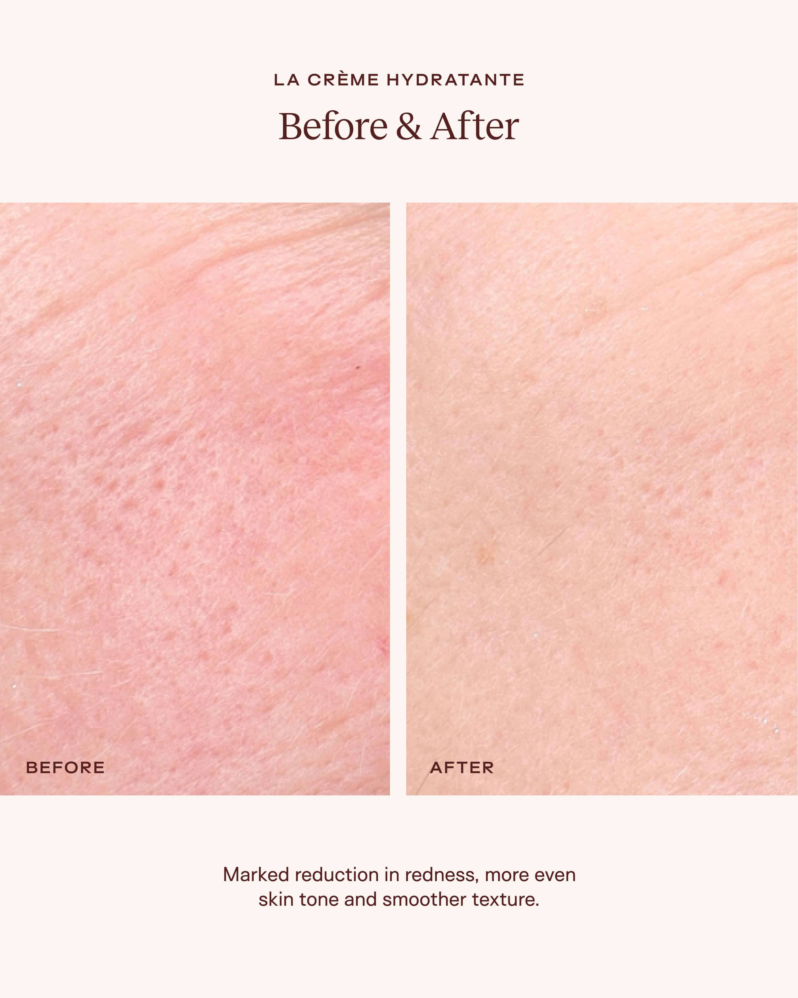 La Crème Hydratante – Beta-Glucan Mushroom Moisturizer - Image 3