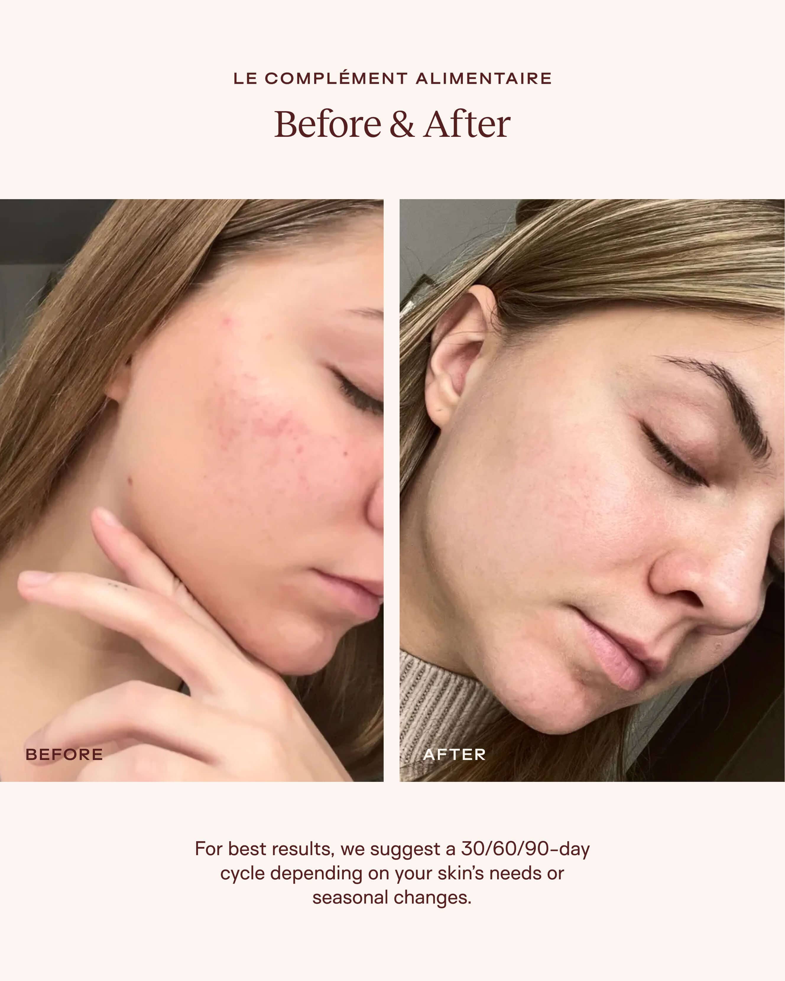 Le Complément Alimentaire – Ceramide-Rich Skin Supplement - Image 3