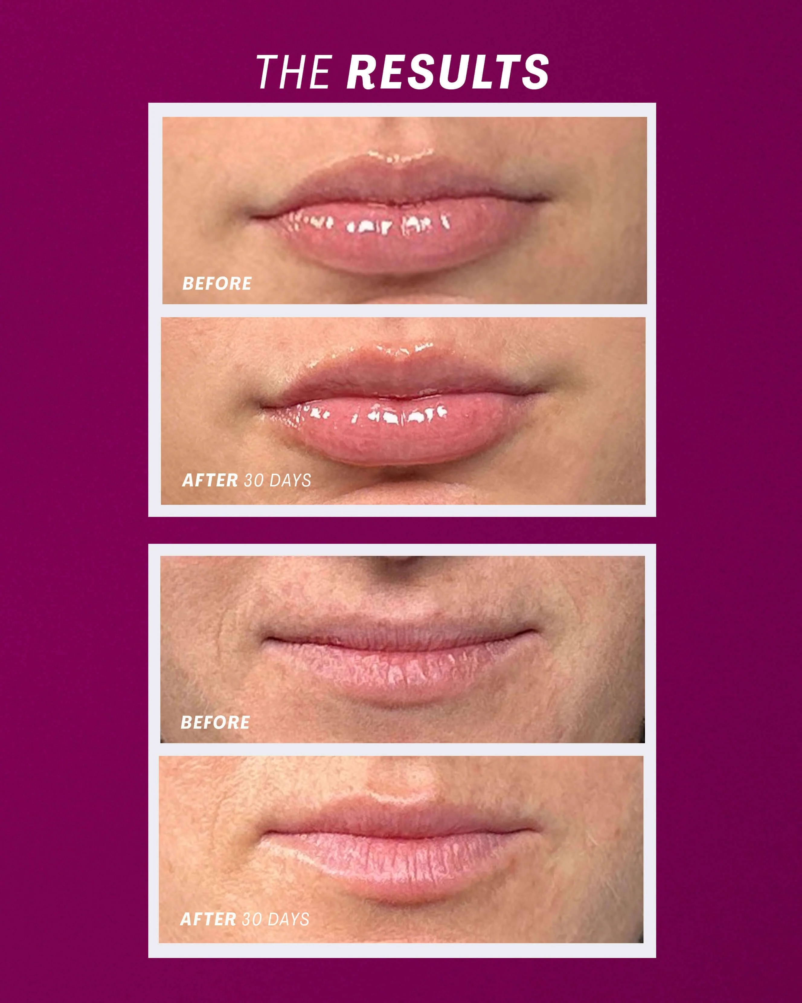 Lip Oasis™️ Glossy Treatment - Image 17