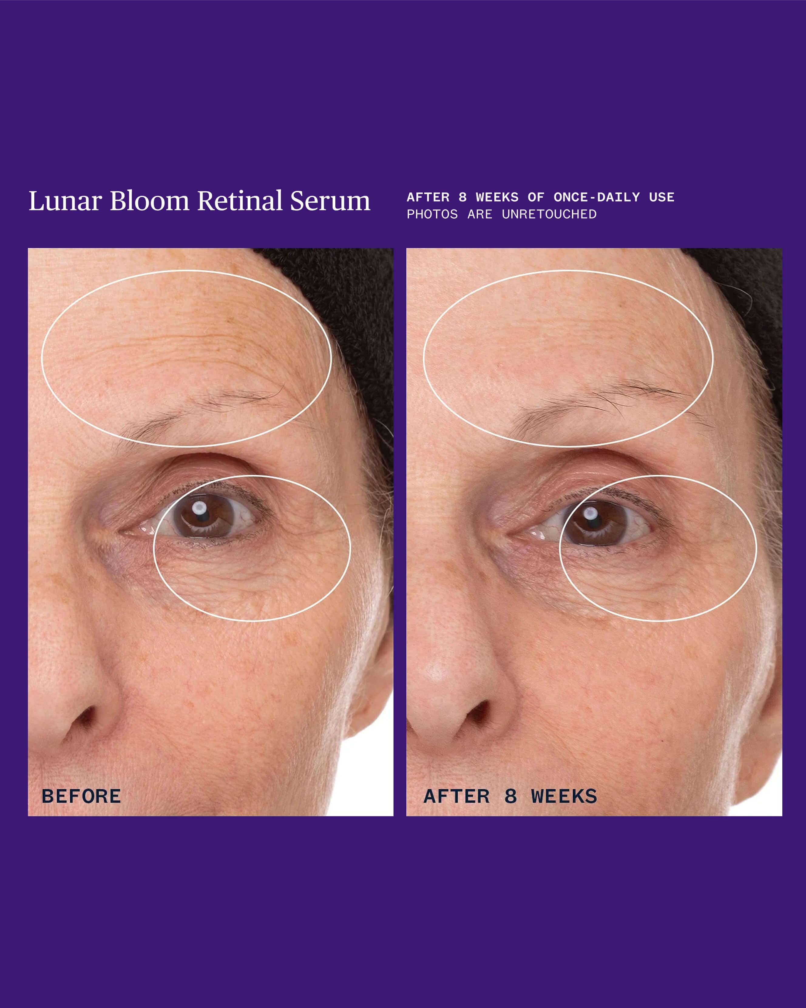 Lunar Bloom Retinol Serum for Fine Lines, Wrinkles & Uneven Skin Tone - Image 3