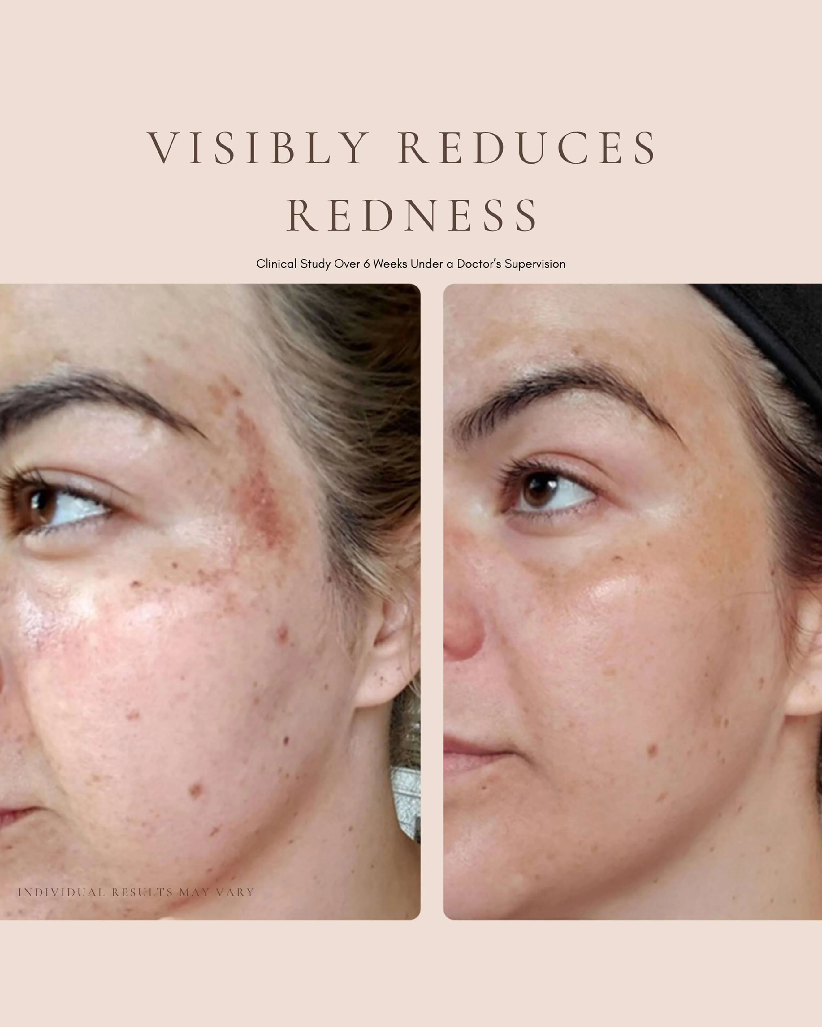 Luxury Beauty Serum - Image 3