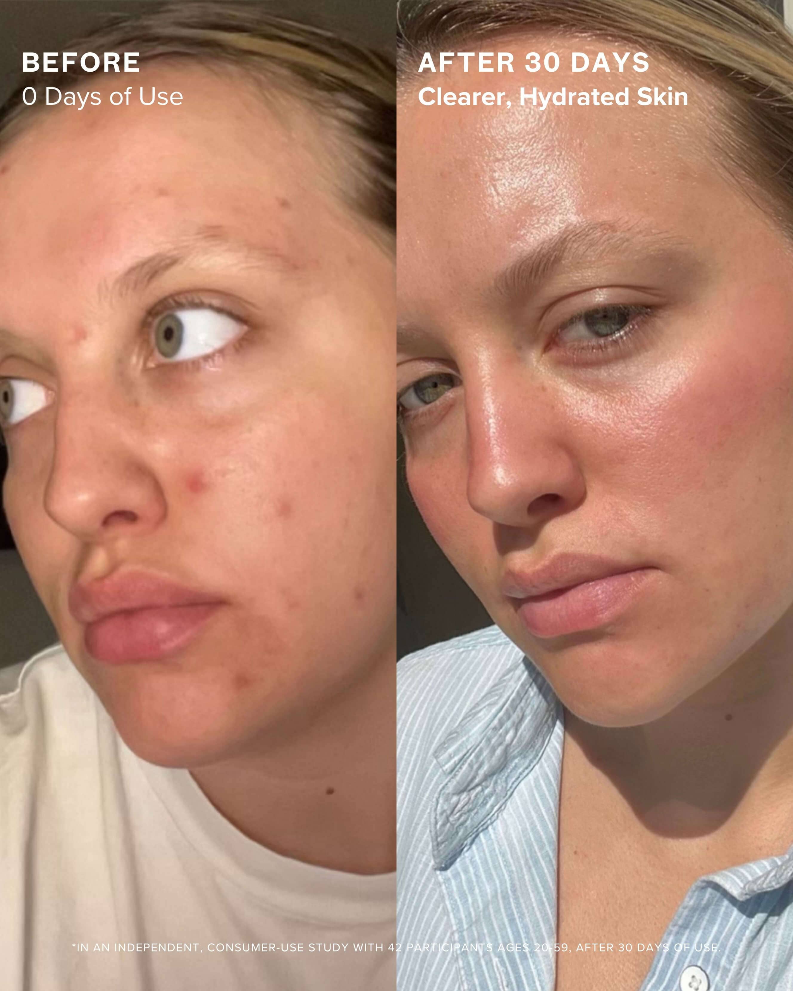 Clear Skin Mineral Milk 2% Salicylic Acid Acne Treatment with Niacinamide + Copper - Image 4
