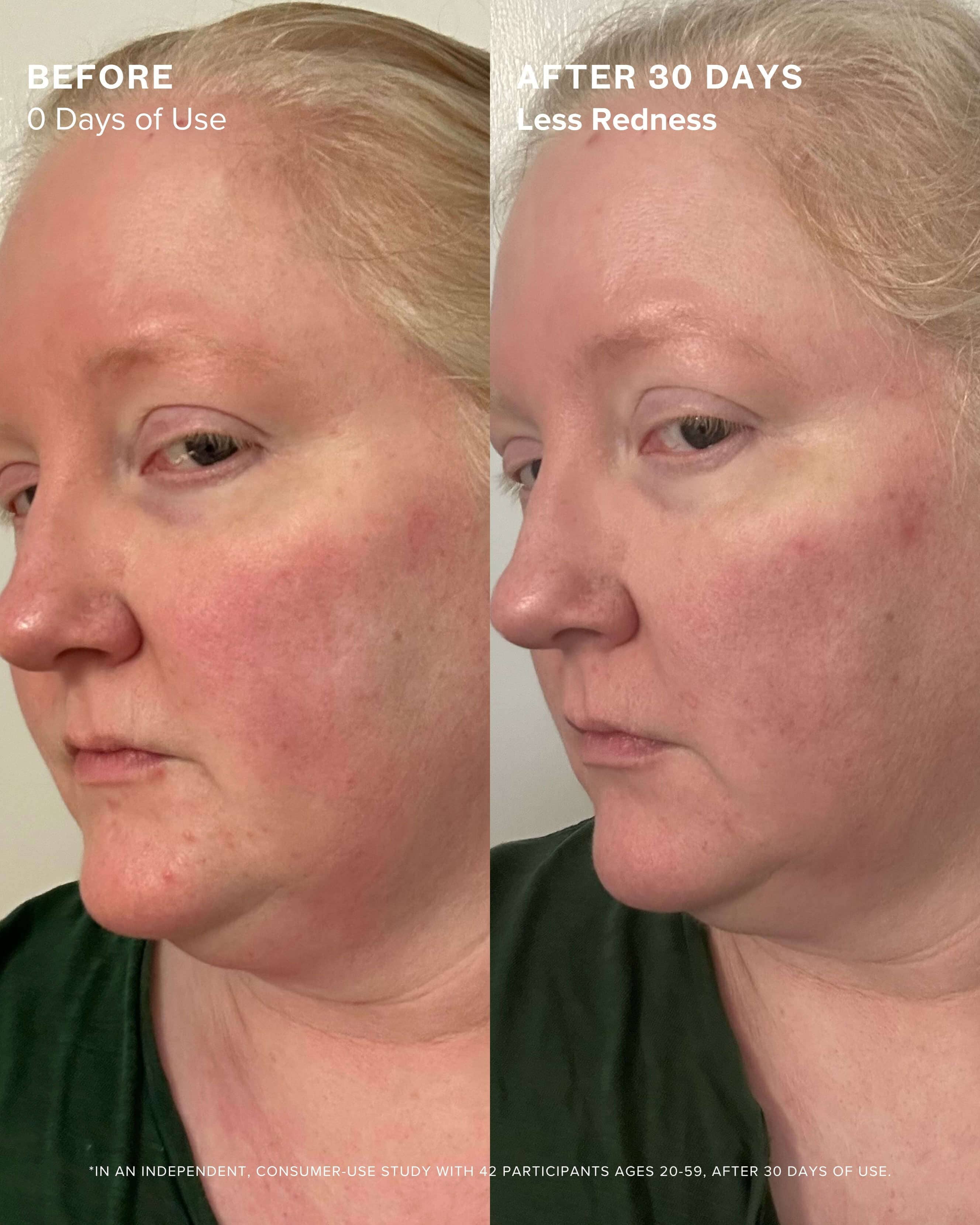 Clear Skin Mineral Milk 2% Salicylic Acid Acne Treatment with Niacinamide + Copper - Image 5