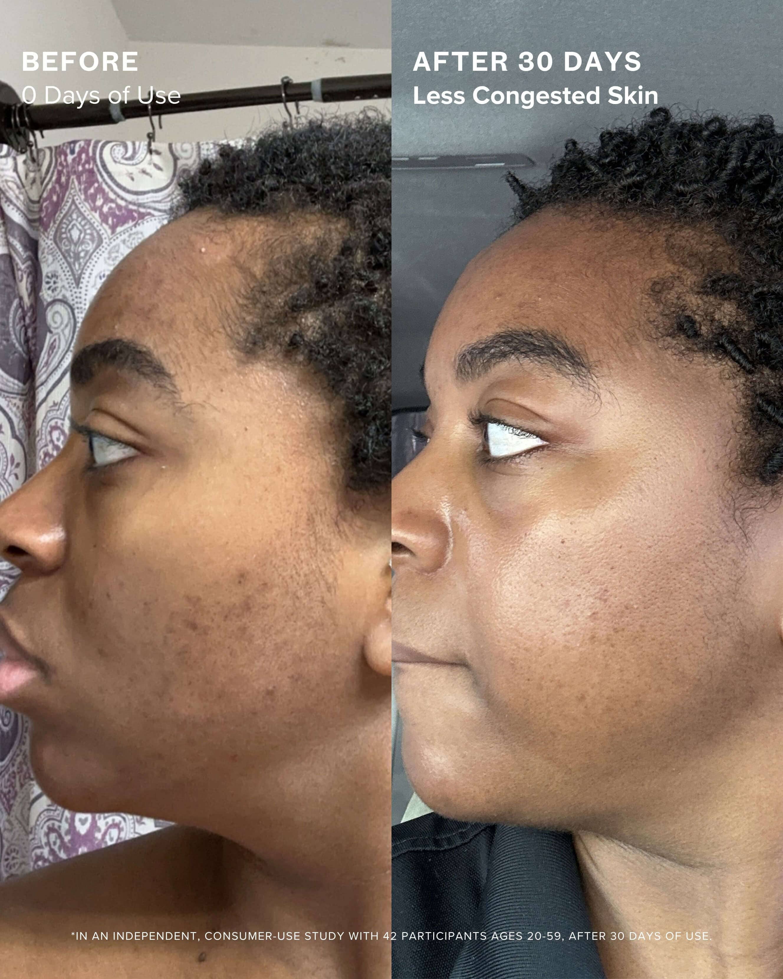 Clear Skin Mineral Milk 2% Salicylic Acid Acne Treatment with Niacinamide + Copper - Image 6