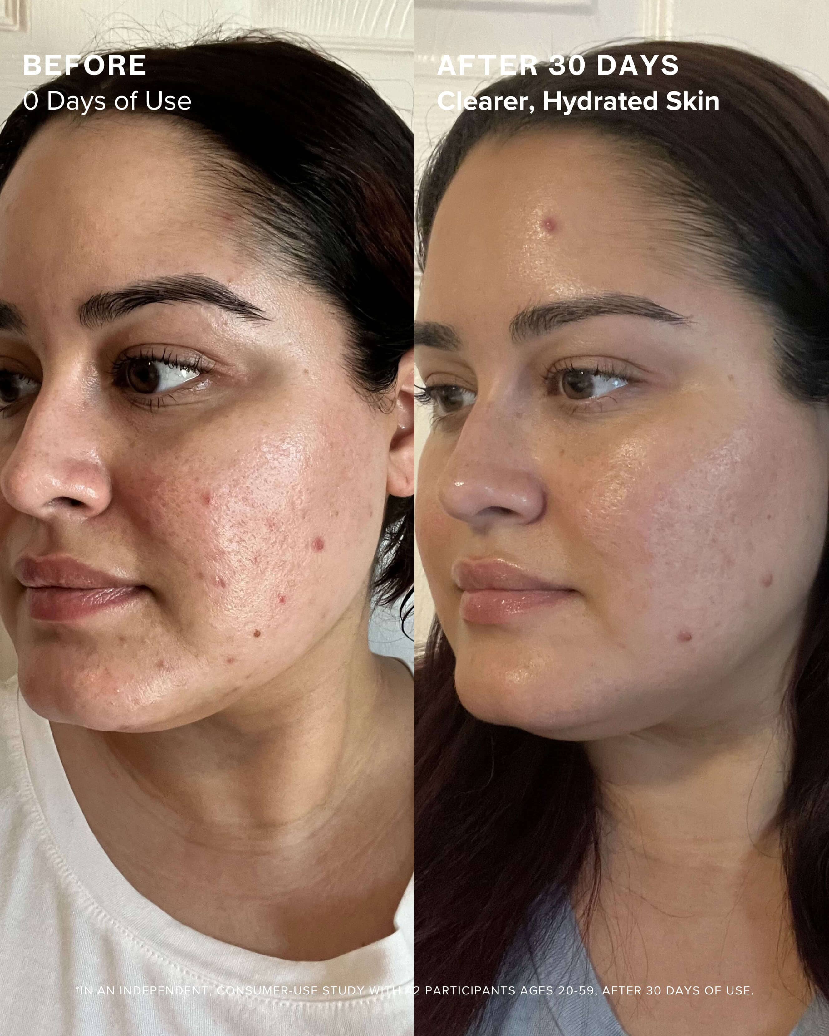 Clear Skin Mineral Milk 2% Salicylic Acid Acne Treatment with Niacinamide + Copper - Image 7
