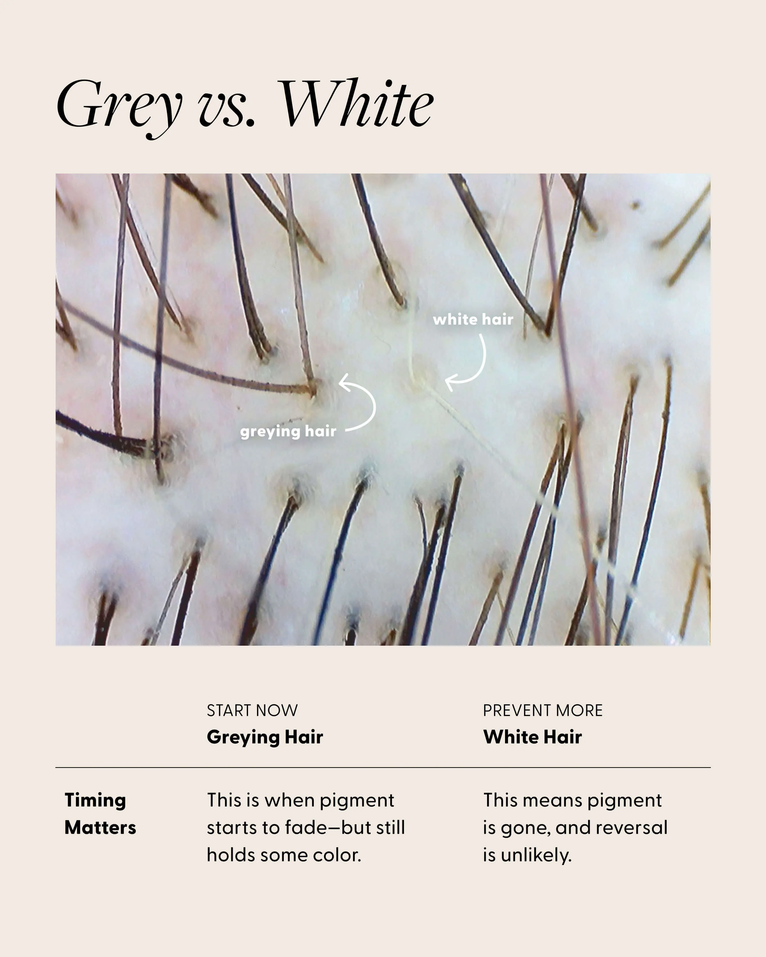 Not Today, Grey Supplement - Image 8