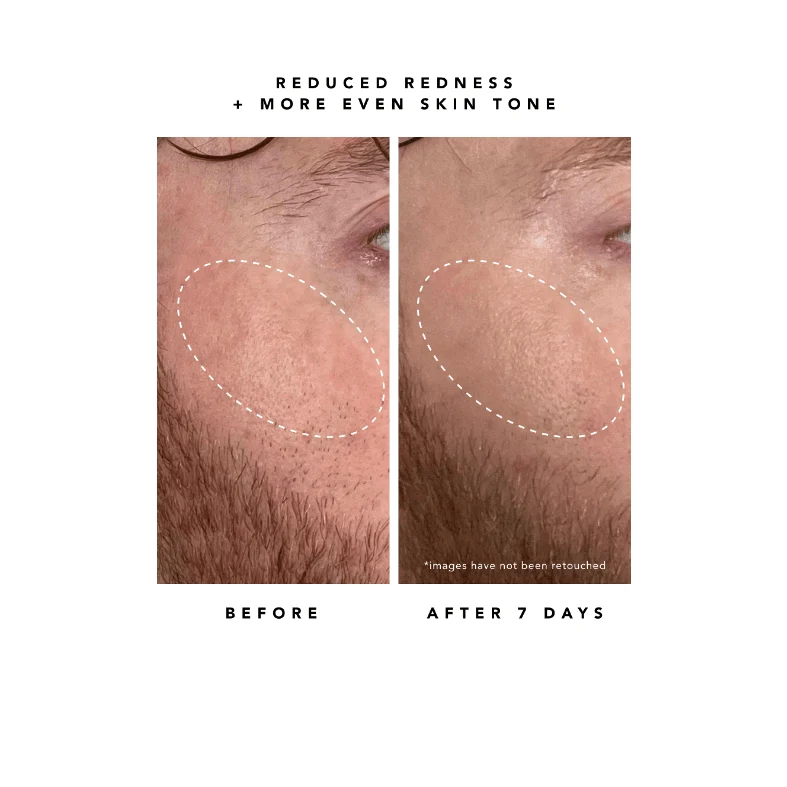 Nova 15% Vitamin C + Turmeric Brightening Serum - Image 9