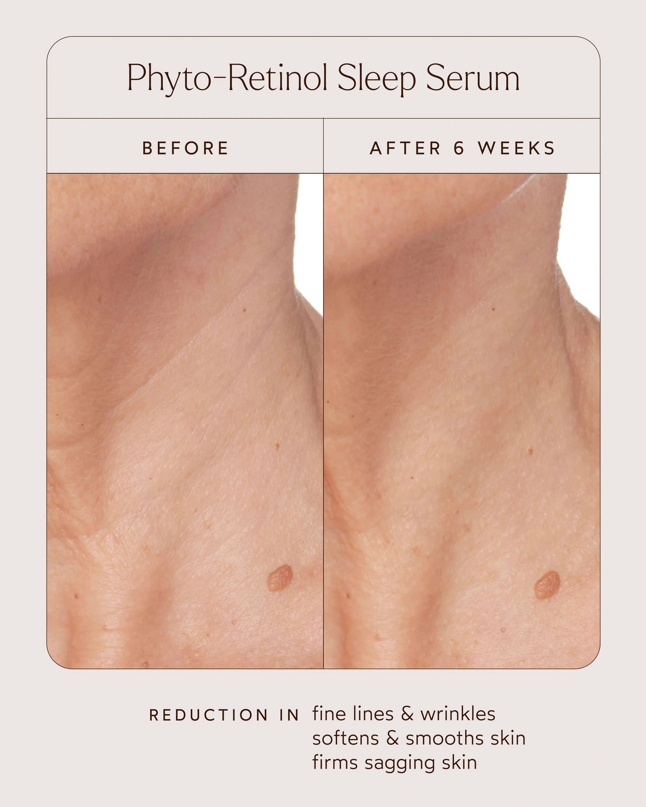 Phyto Retinol Anti-Aging Sleep Serum - Image 4