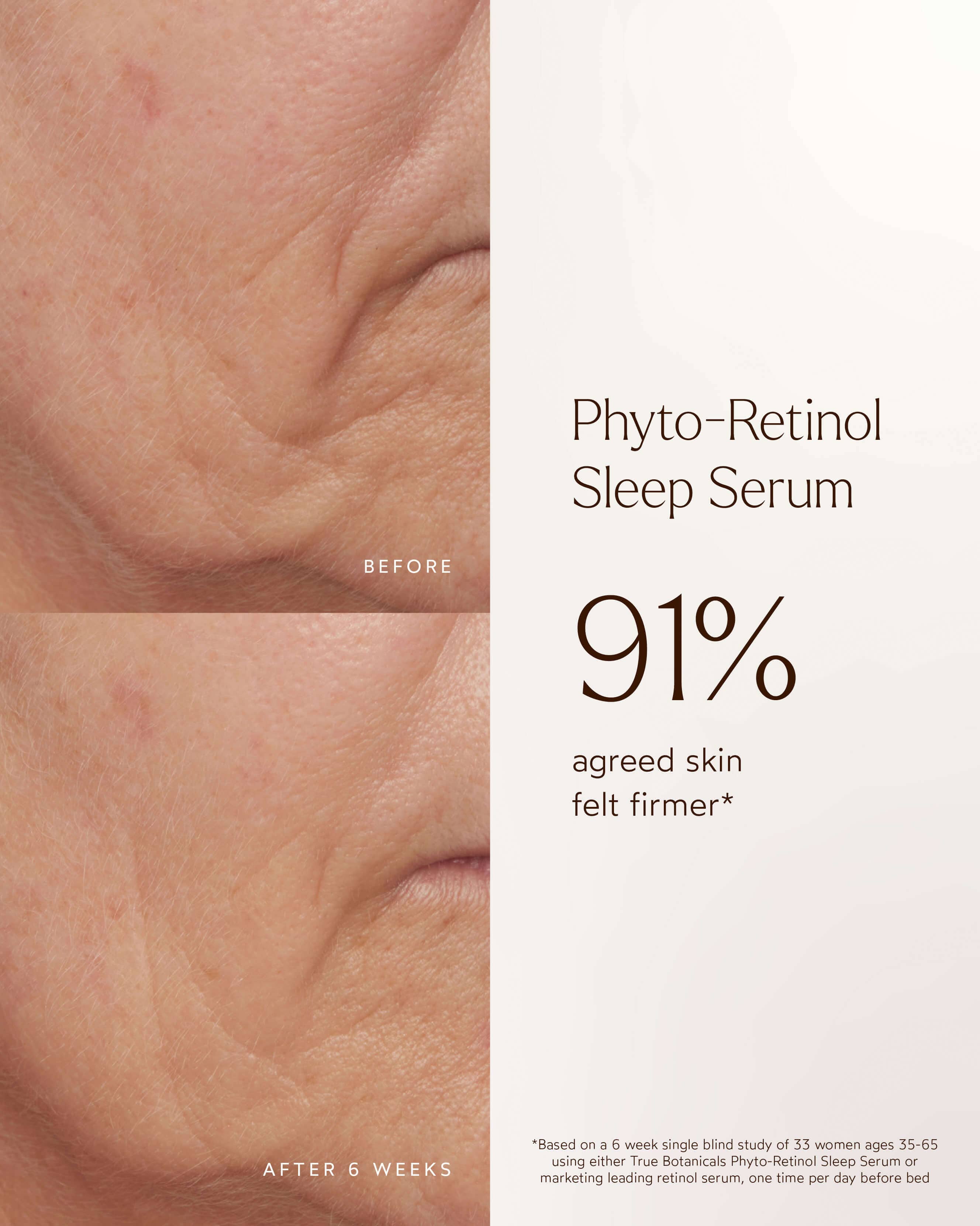 Phyto Retinol Anti-Aging Sleep Serum - Image 5