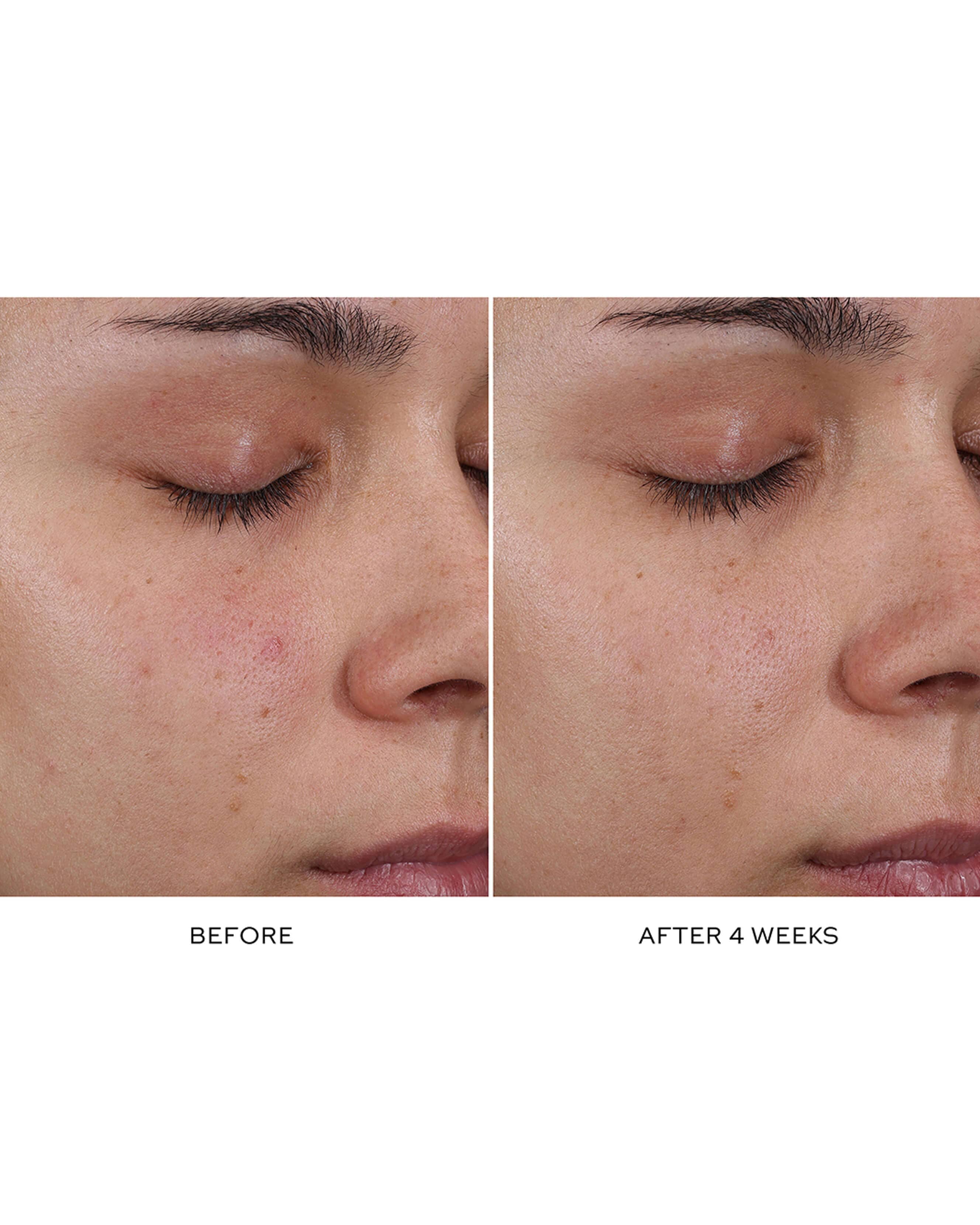 Pore Refining Complex - Image 3