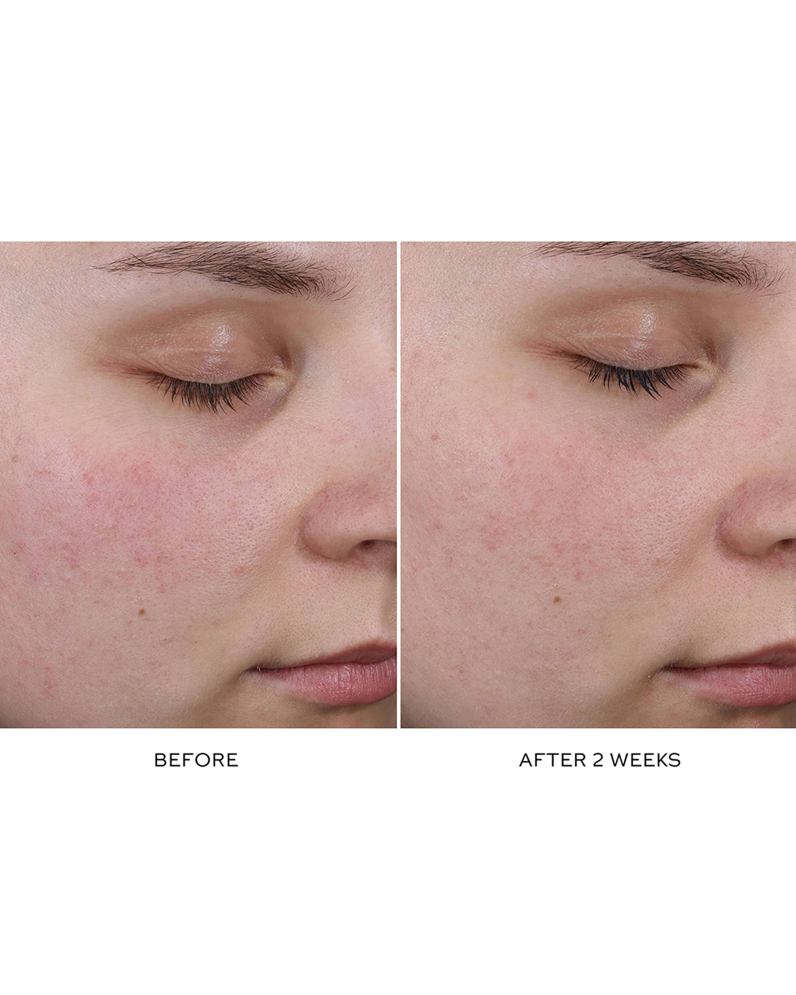 Pore Refining Complex - Image 4