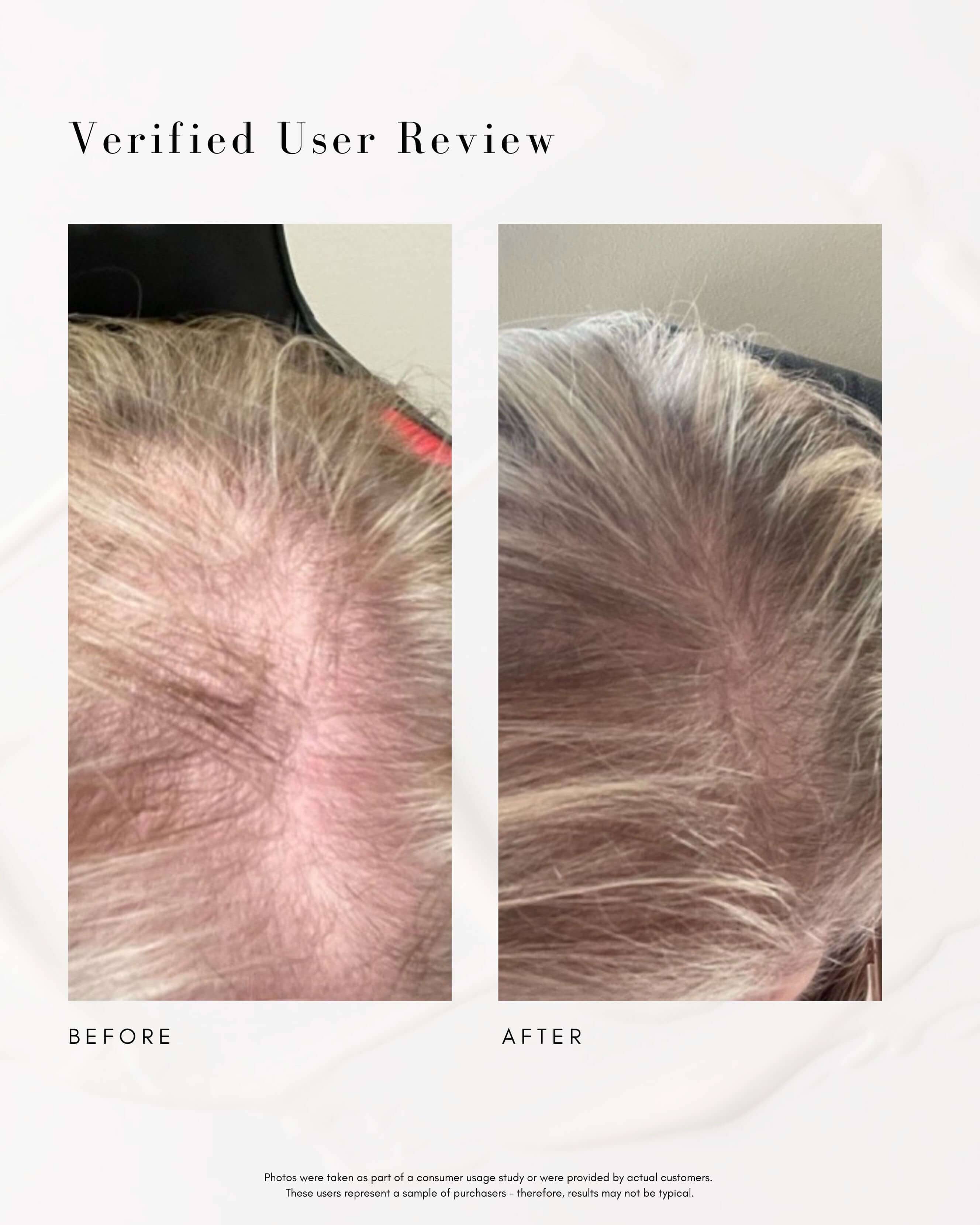 Power Fol Multi-Correctional Scalp and Hair Treatment - Image 3