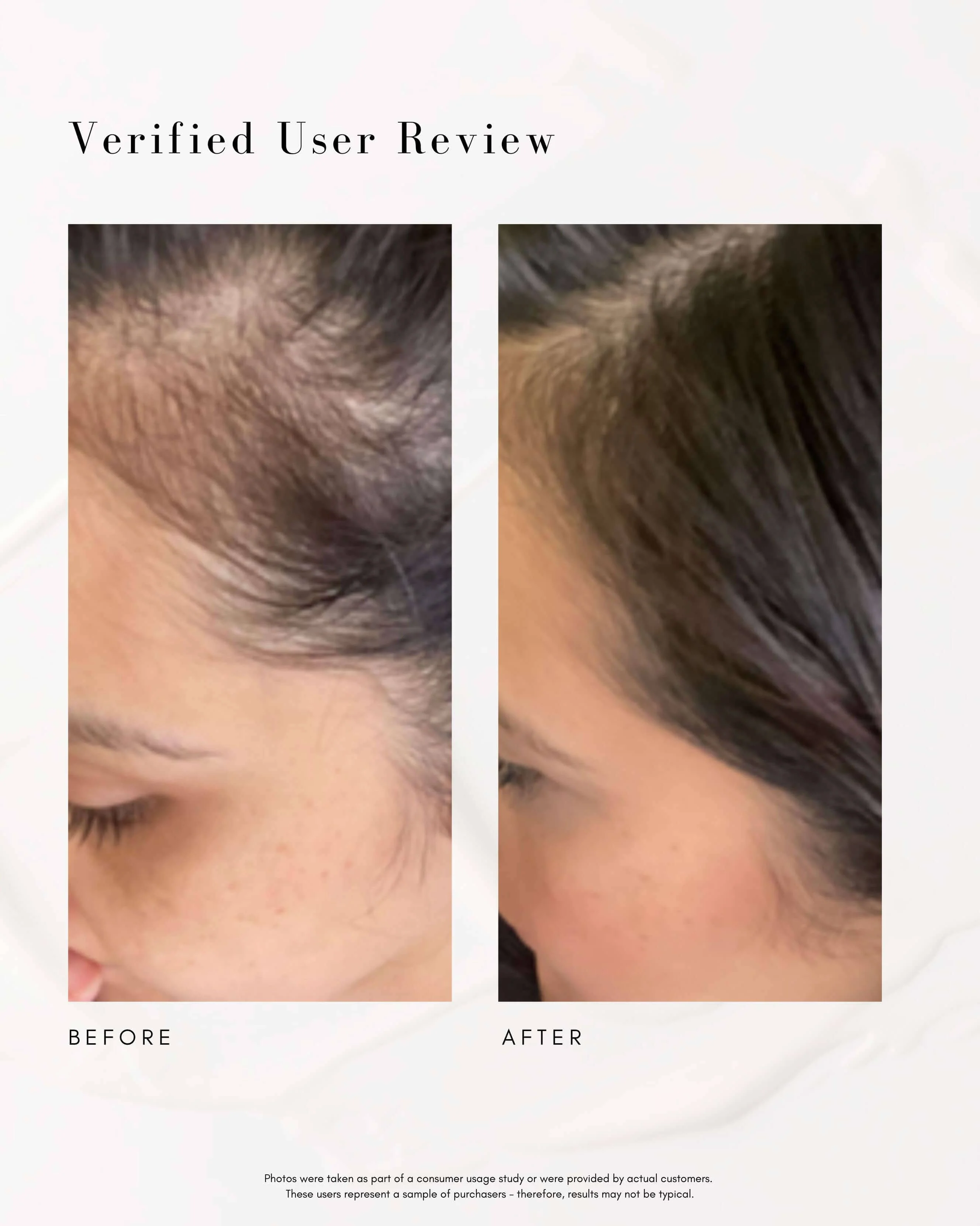 Power Fol Multi-Correctional Scalp and Hair Treatment - Image 4