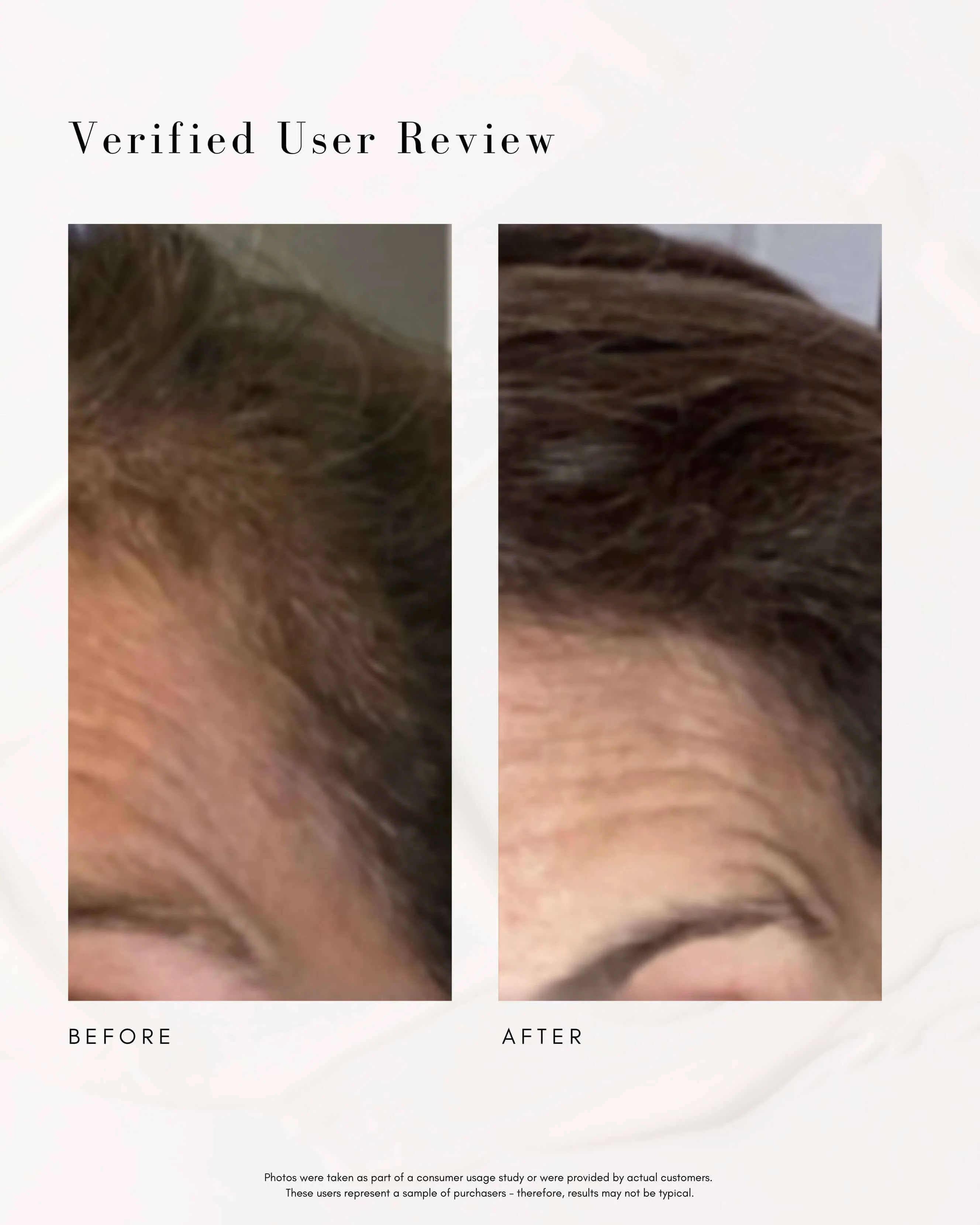 Power Fol Multi-Correctional Scalp and Hair Treatment - Image 6