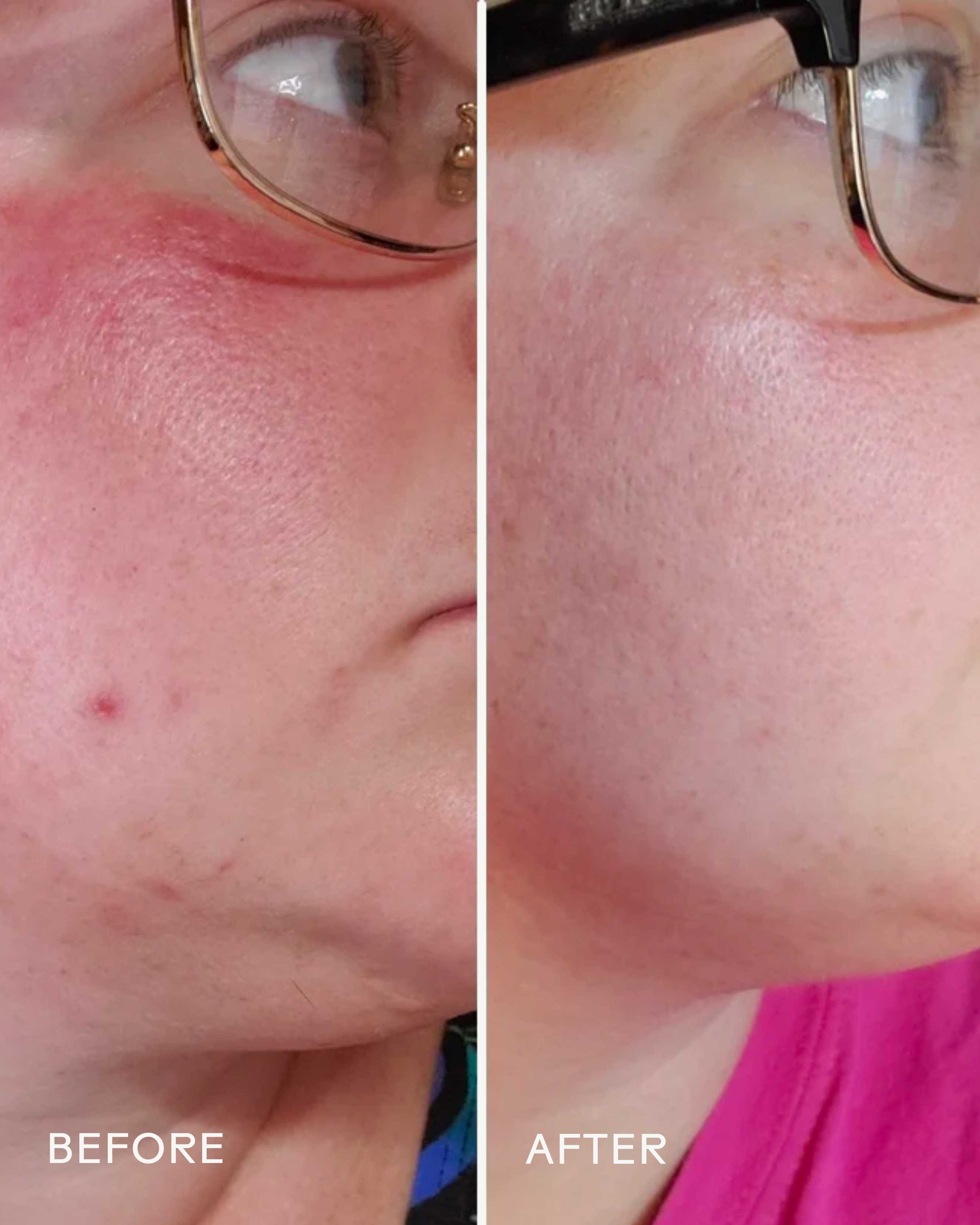 Radiance Grape Stem Cell + Squalane Day Cream - Image 6