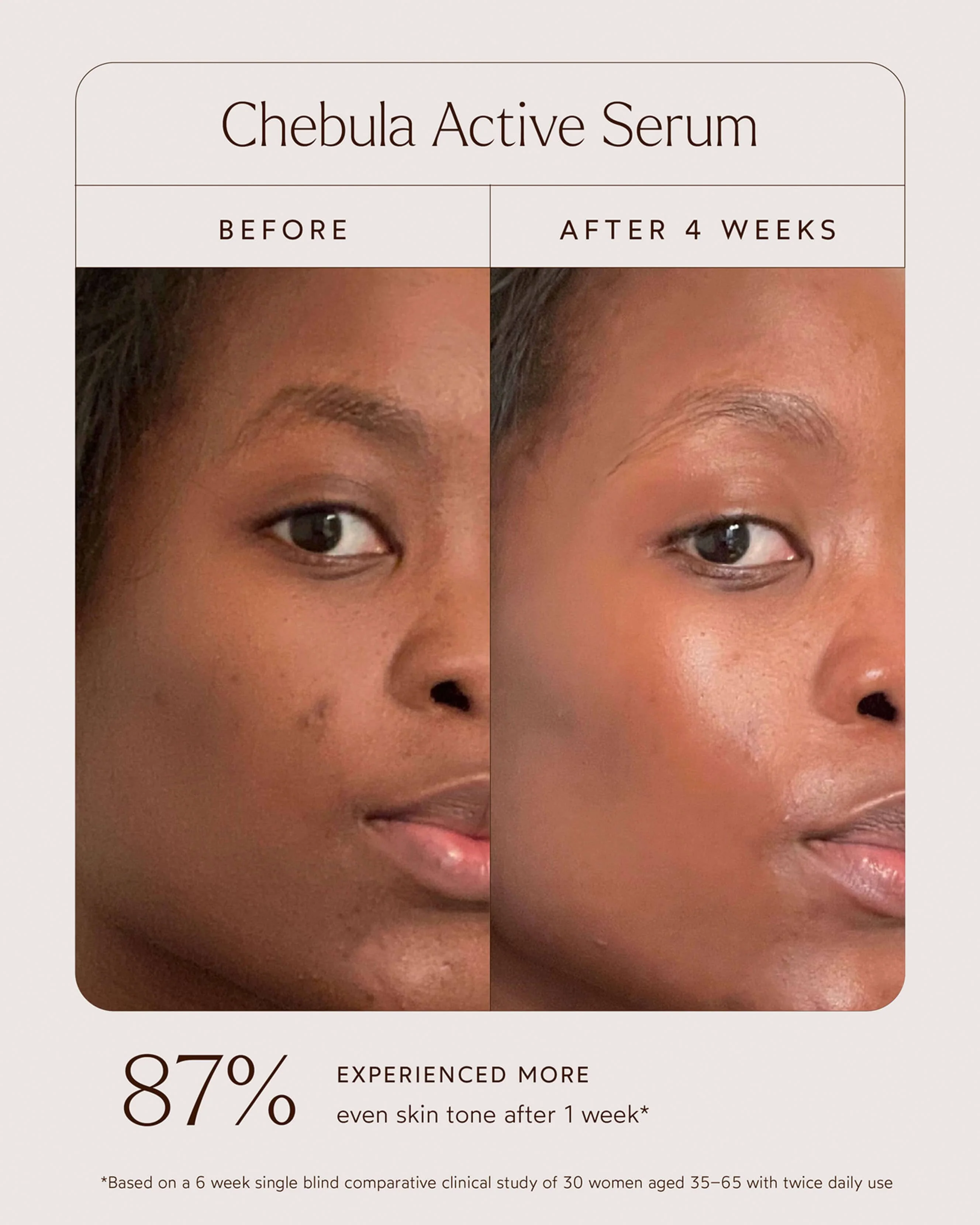 Chebula Active Anti-Aging Serum - Image 5