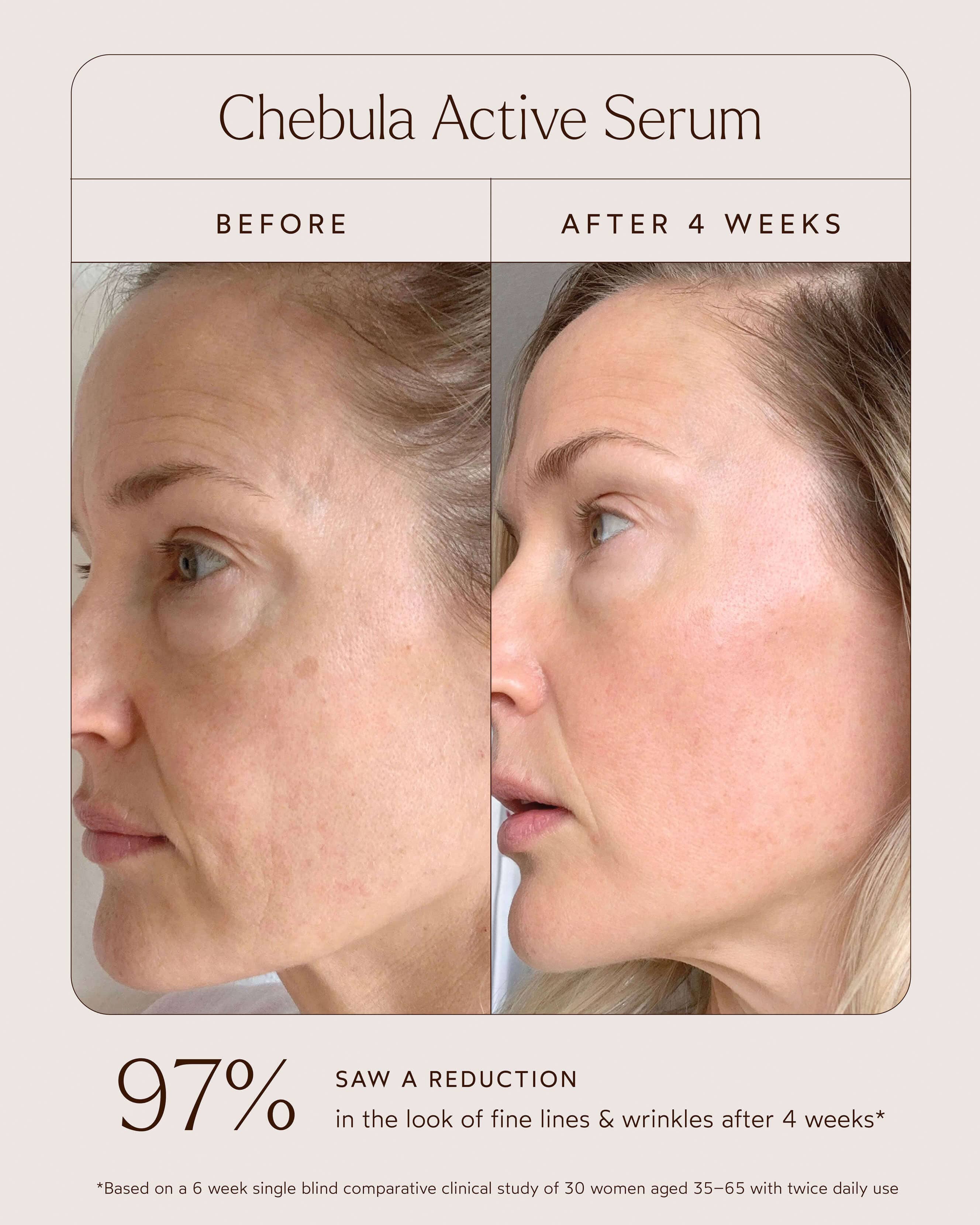 Chebula Active Anti-Aging Serum - Image 6