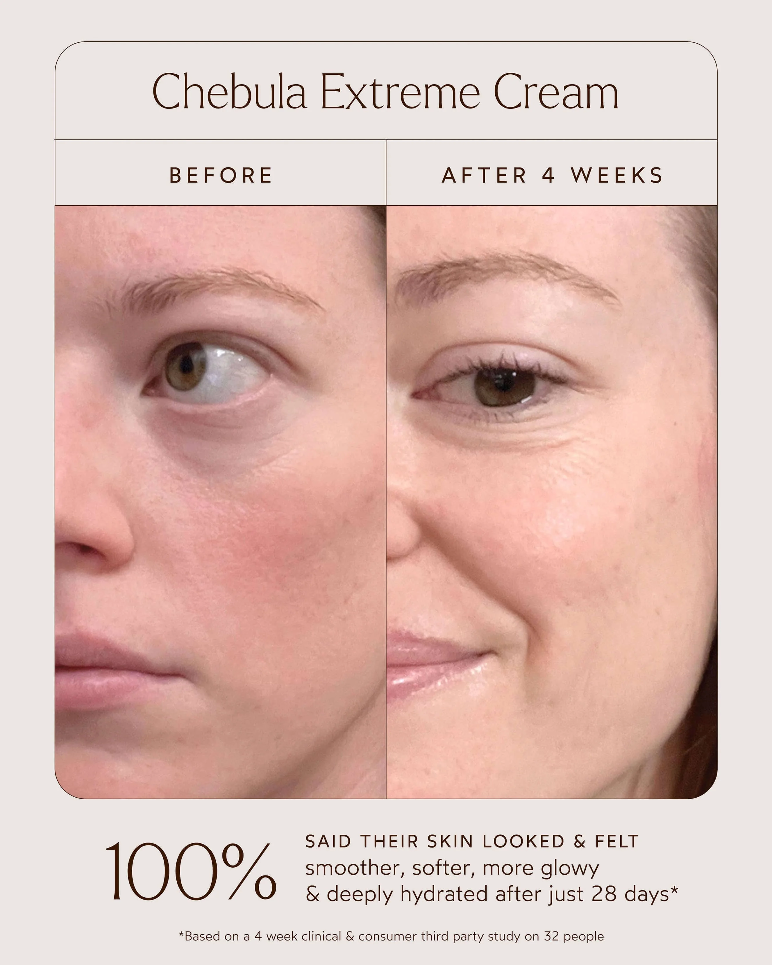 Chebula Extreme Moisture Cream - Image 16