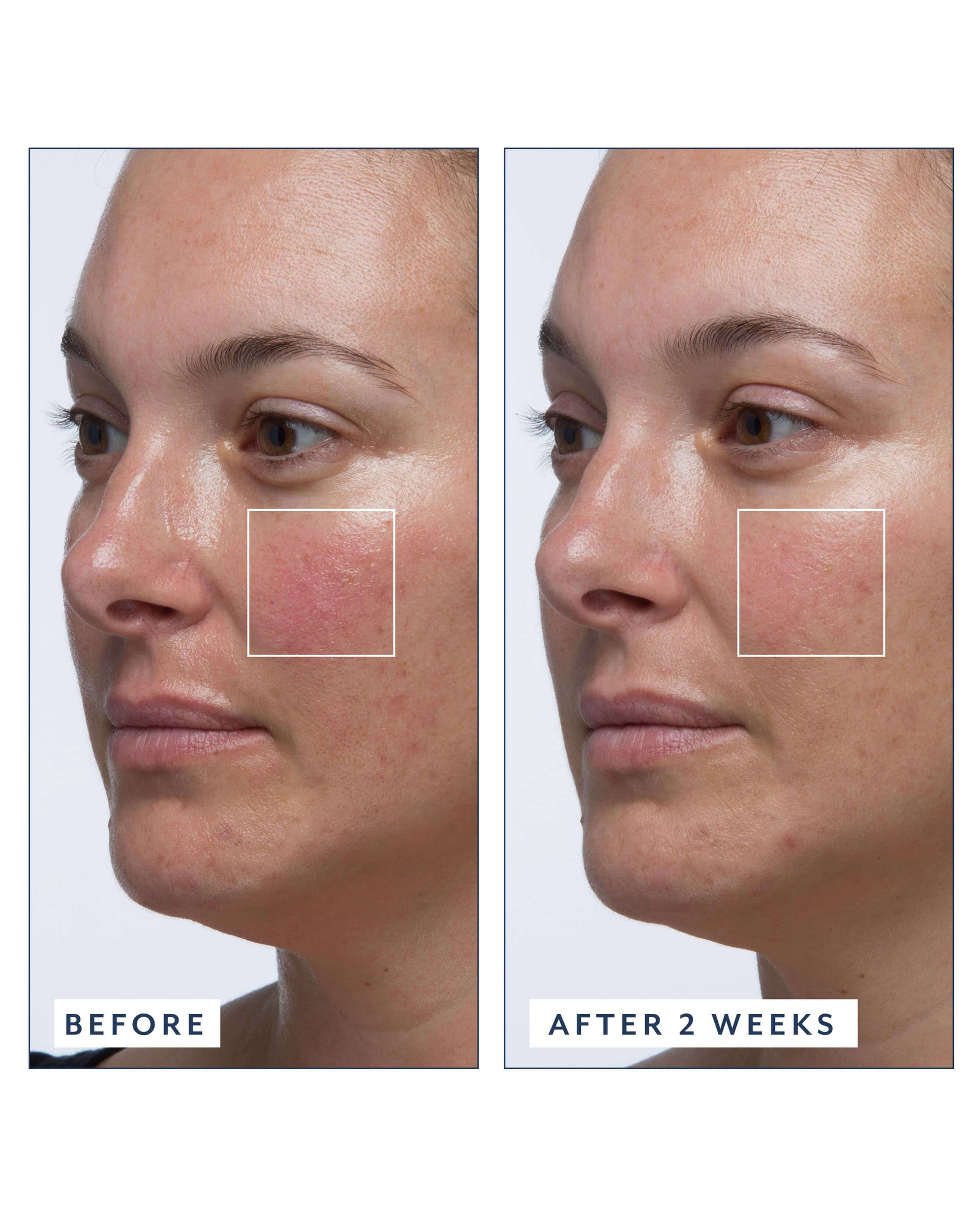 Royal Tulip Vitamin C Facial Oil - Image 4