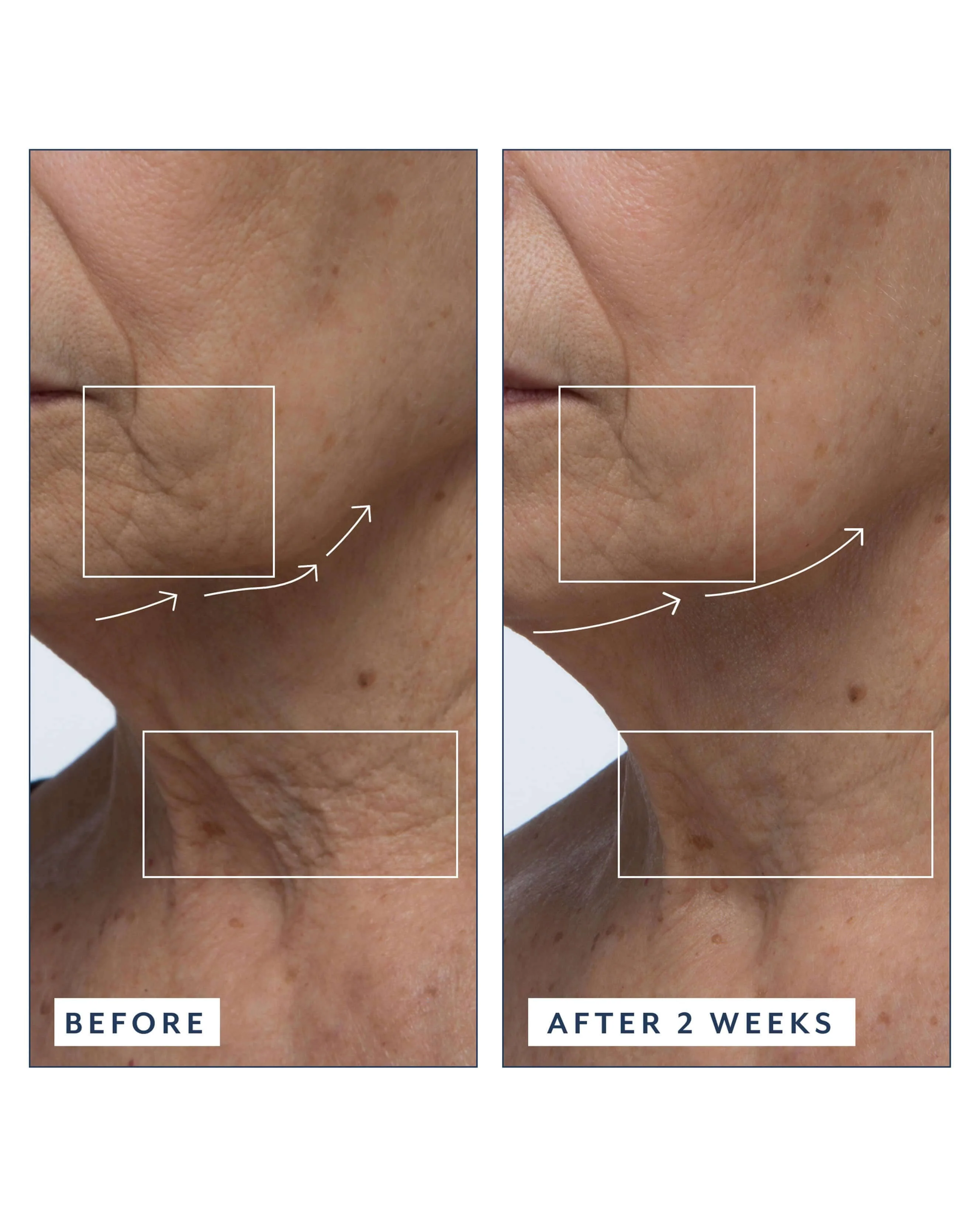 Royal Tulip Vitamin C Facial Oil - Image 5