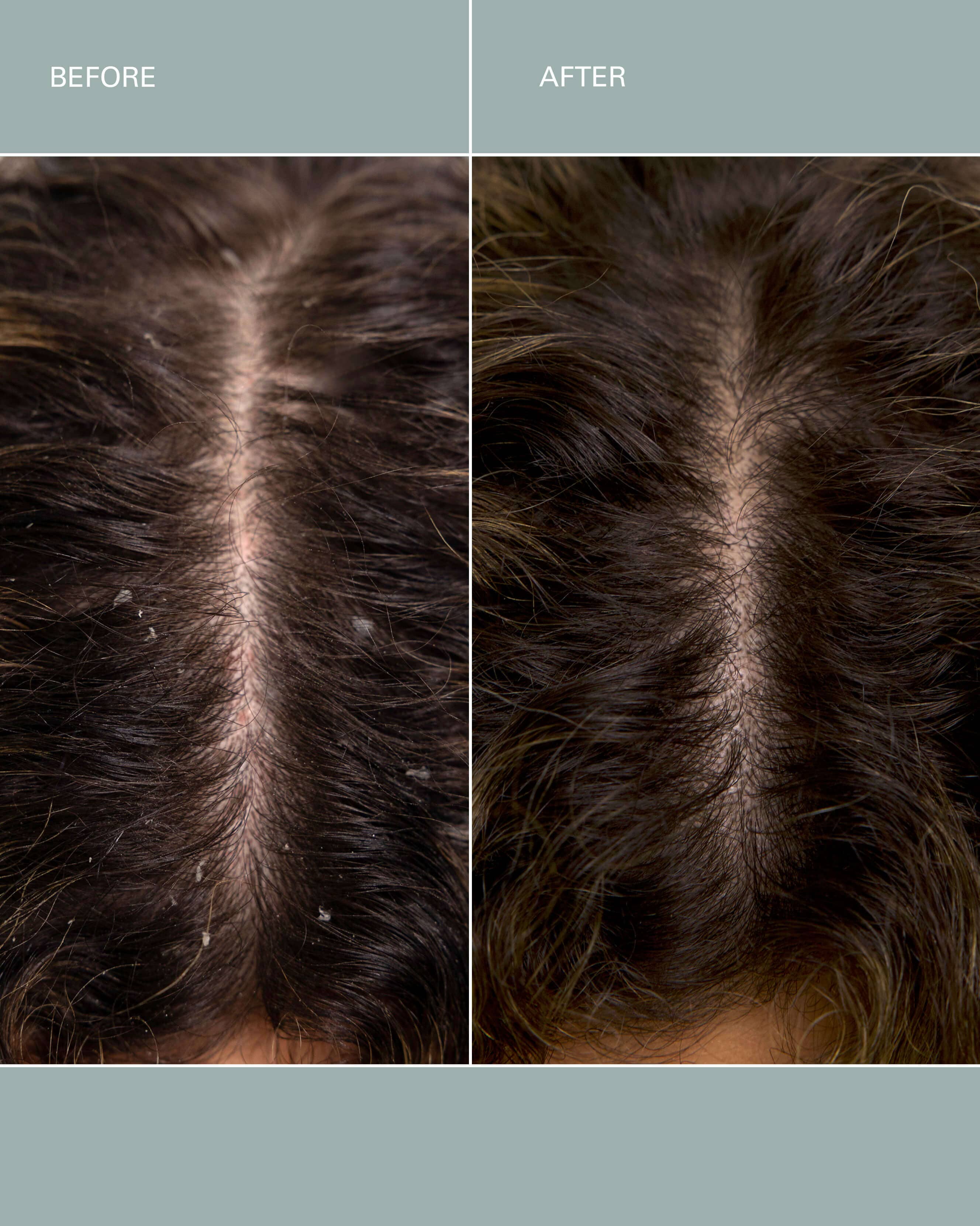 Salt Scalp Scrub - Image 4