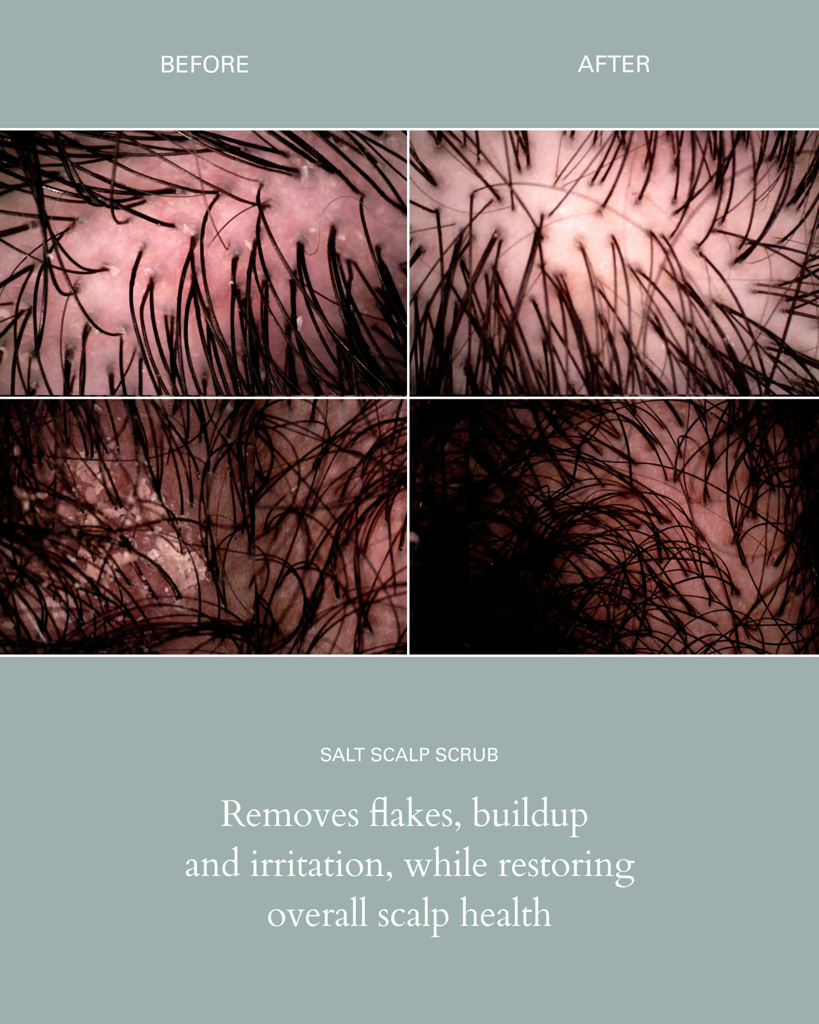 Salt Scalp Scrub - Image 5