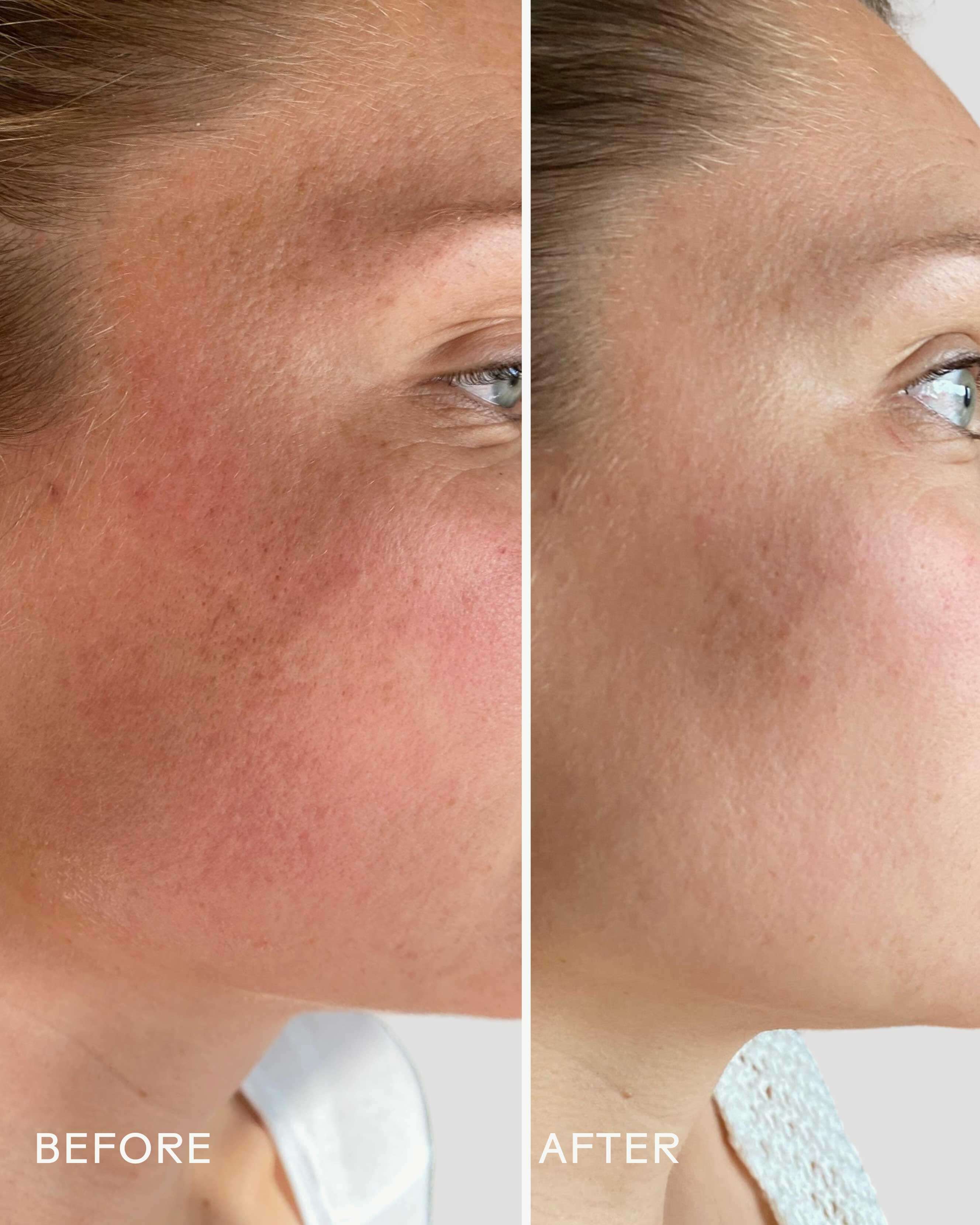 SkinHero™ Bakuchiol + Calendula Bio-Retinol Serum - Image 5
