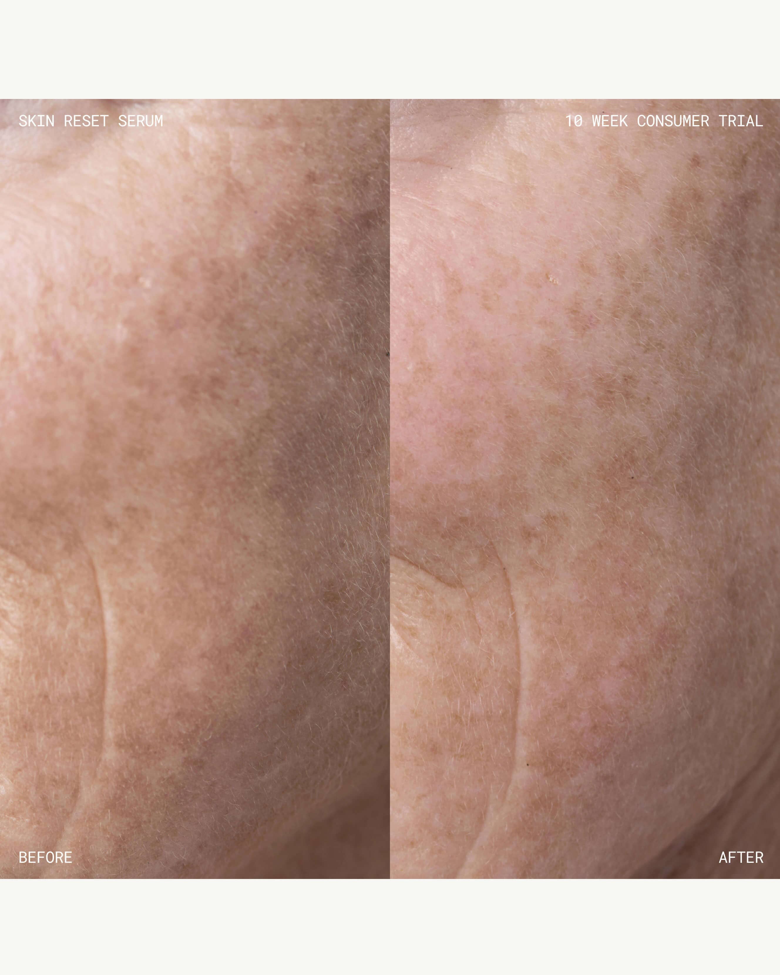 Skin Reset Serum Refill - Image 3
