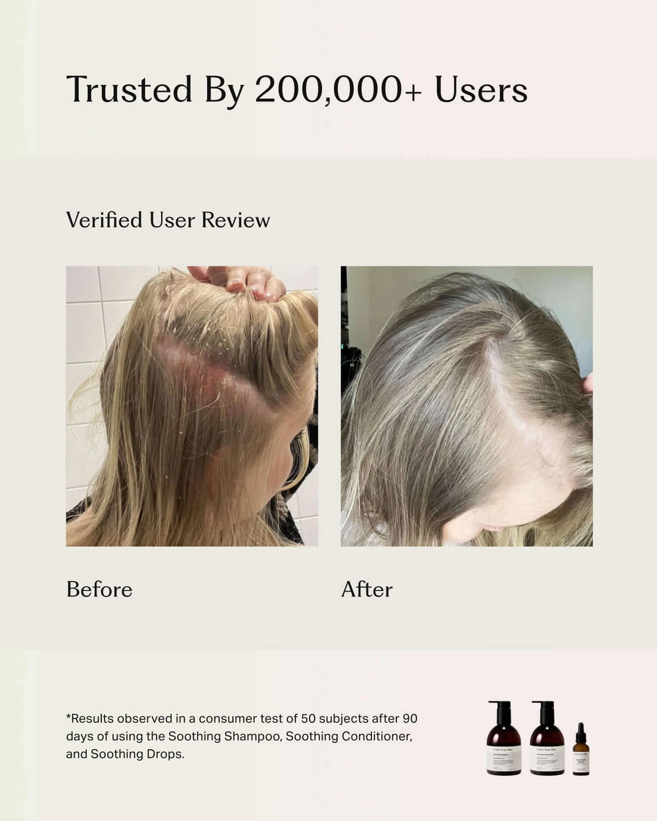Soothing Scalp Treatment Drops - Image 2